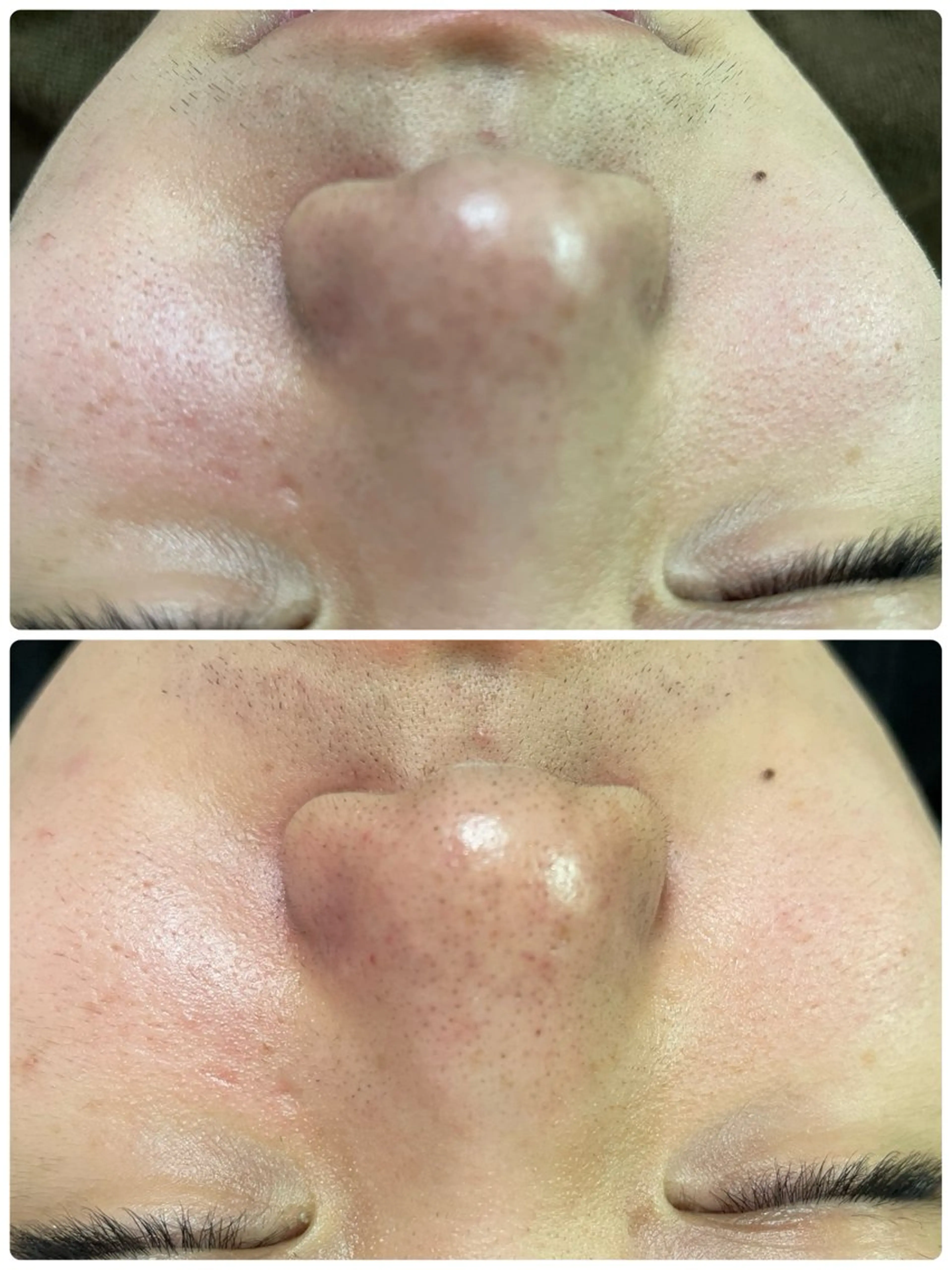 🔰 新米ネイリストのネイルデザイン