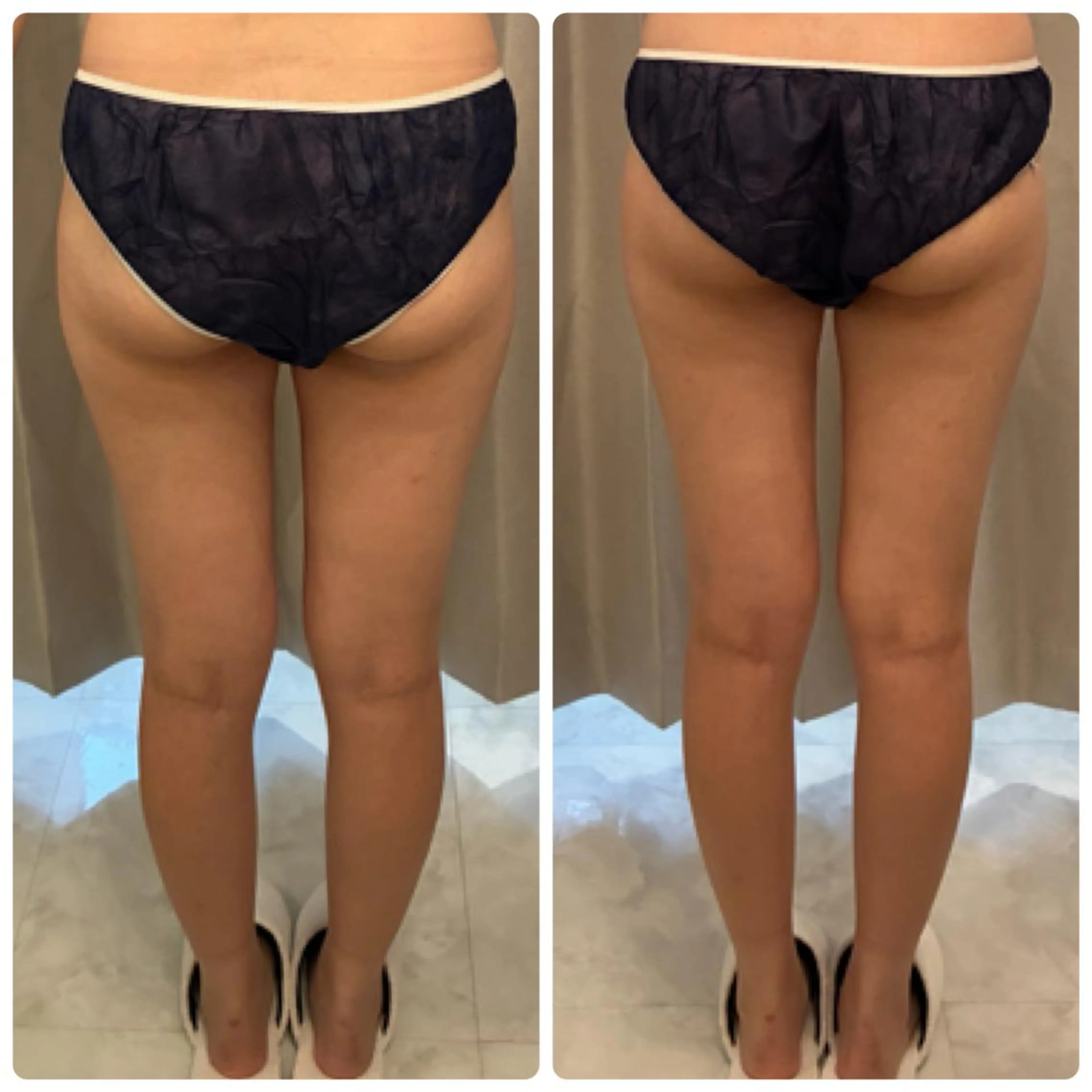 FLEUR 2号店のエステ・リラクイメージ