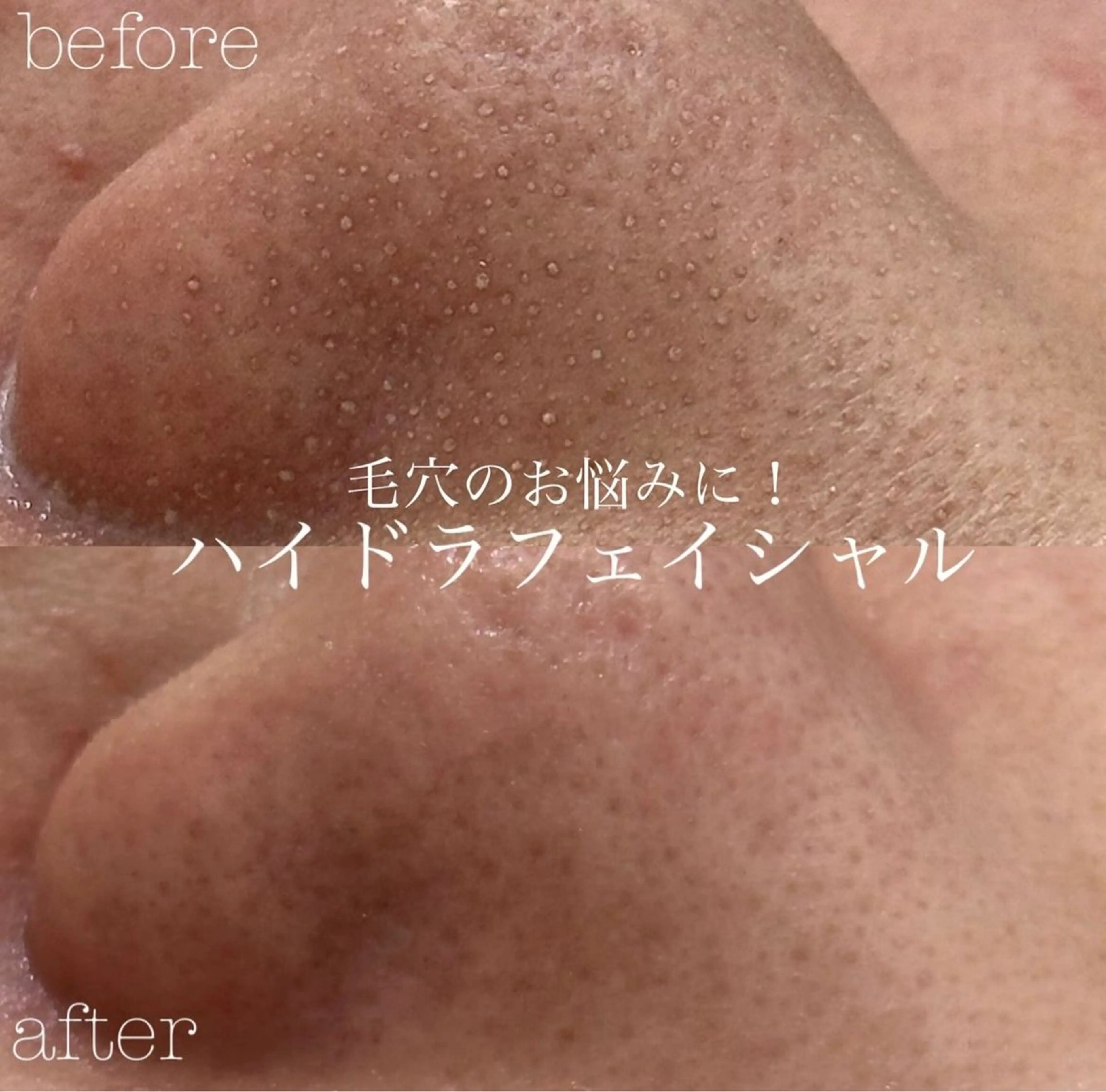 エステ フェイシャルサロン CHIARA 荒田のエステ・リラクイメージ