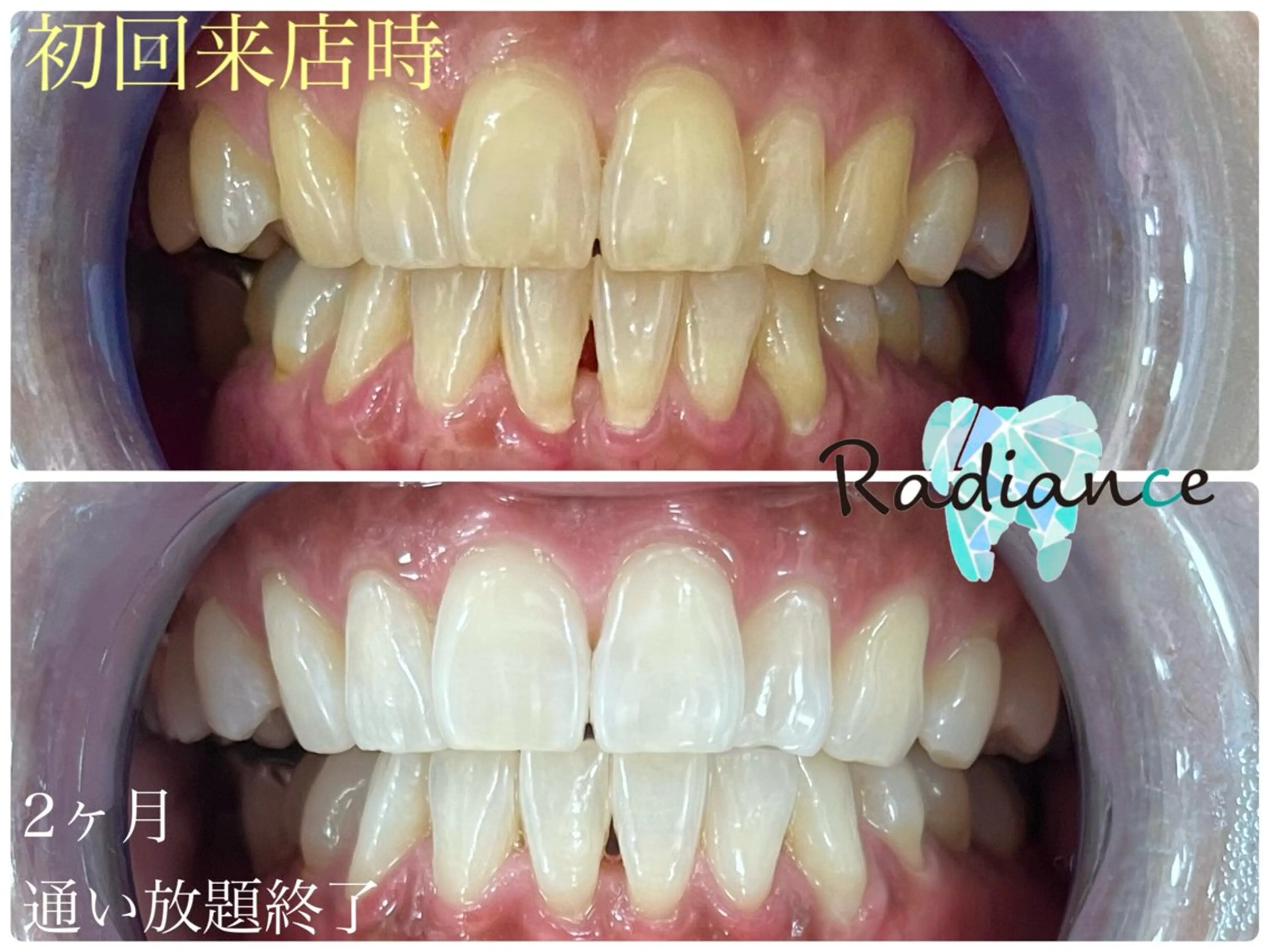 札幌ホワイトニング ラディアンス札幌駅店のその他イメージ