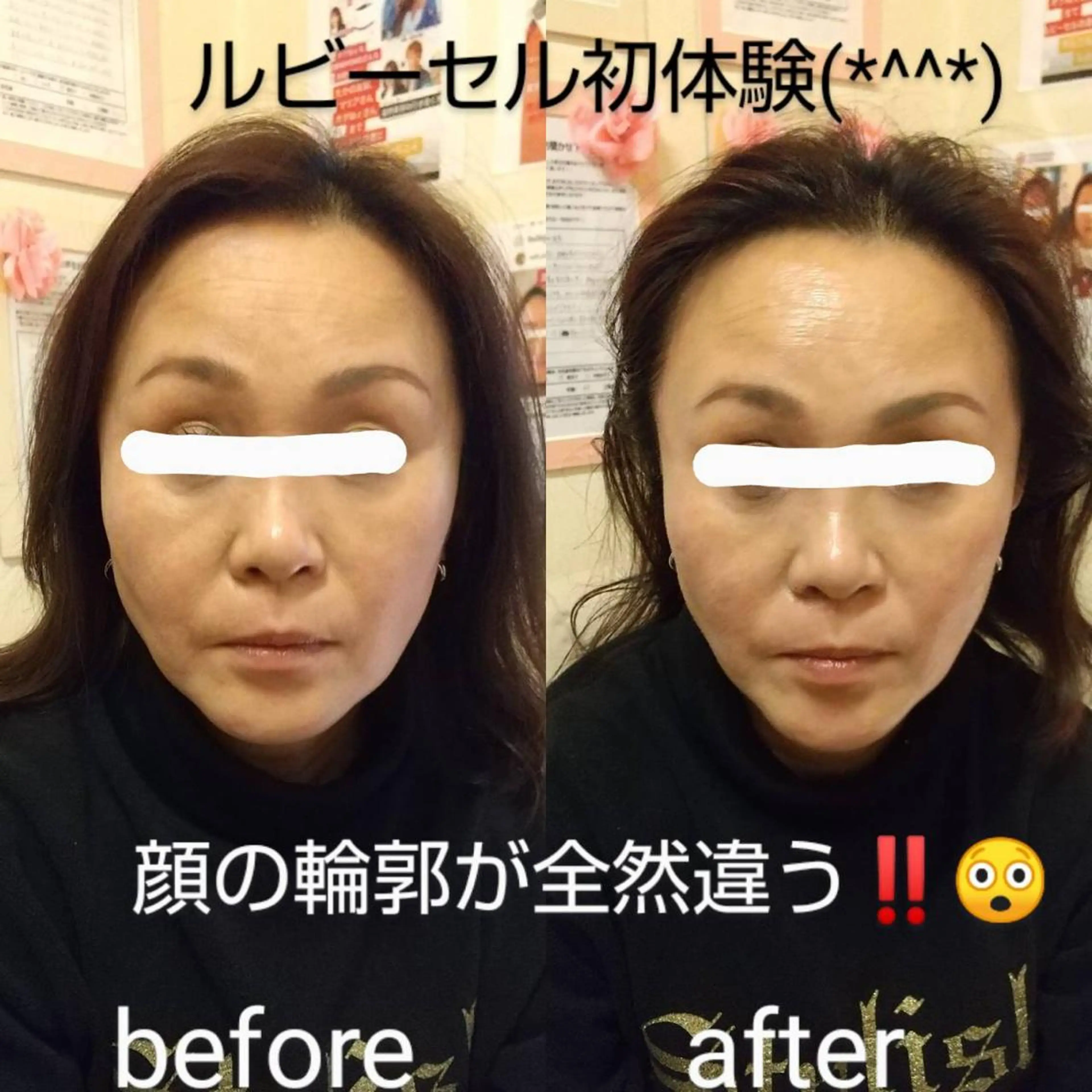 エステ gomi sayakaのエステ・リラクイメージ