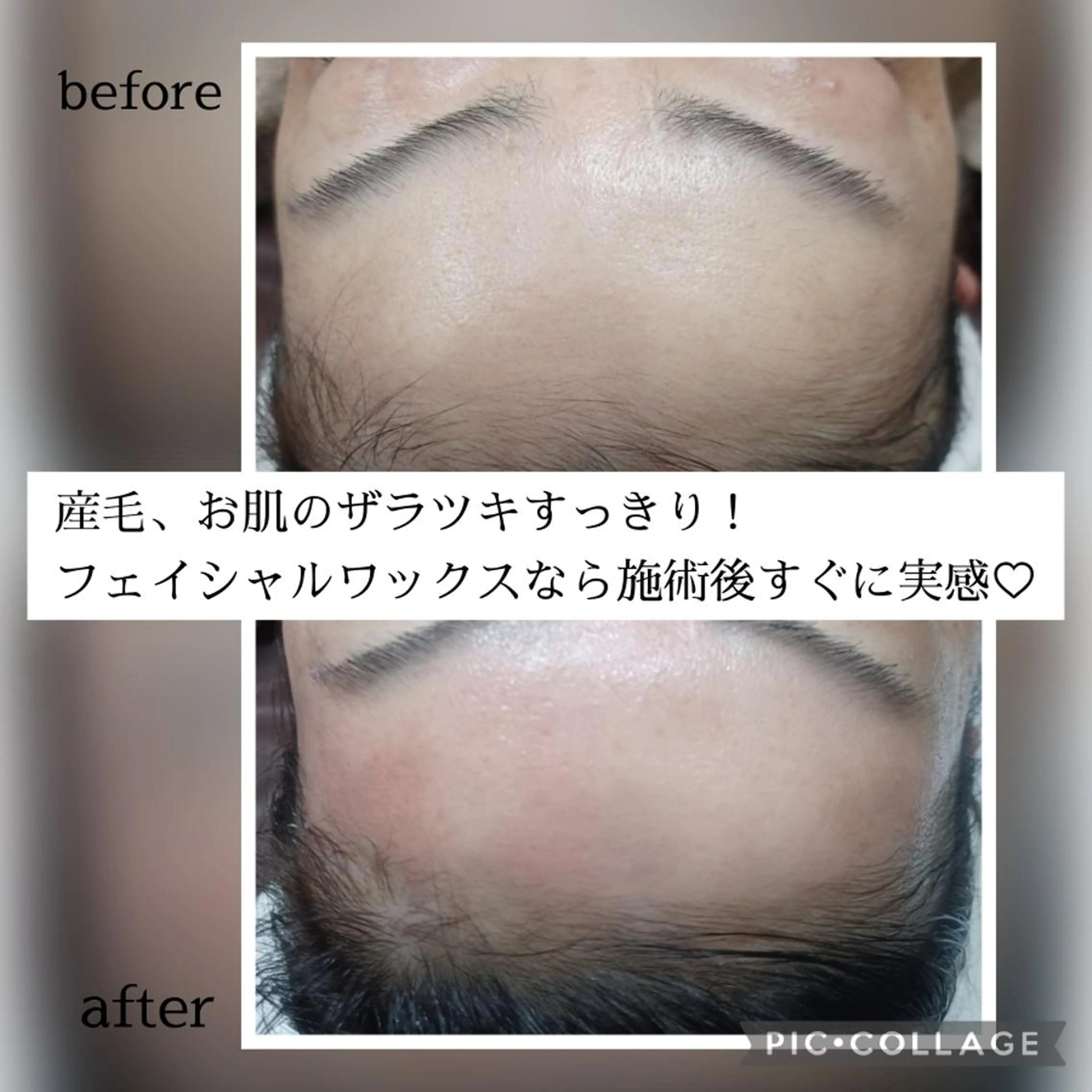 アイブロウ 眉毛ワックス脱毛 脱毛 Lutella所属・ワックス脱毛専門店 Lutellaのエステ・リラクイメージ