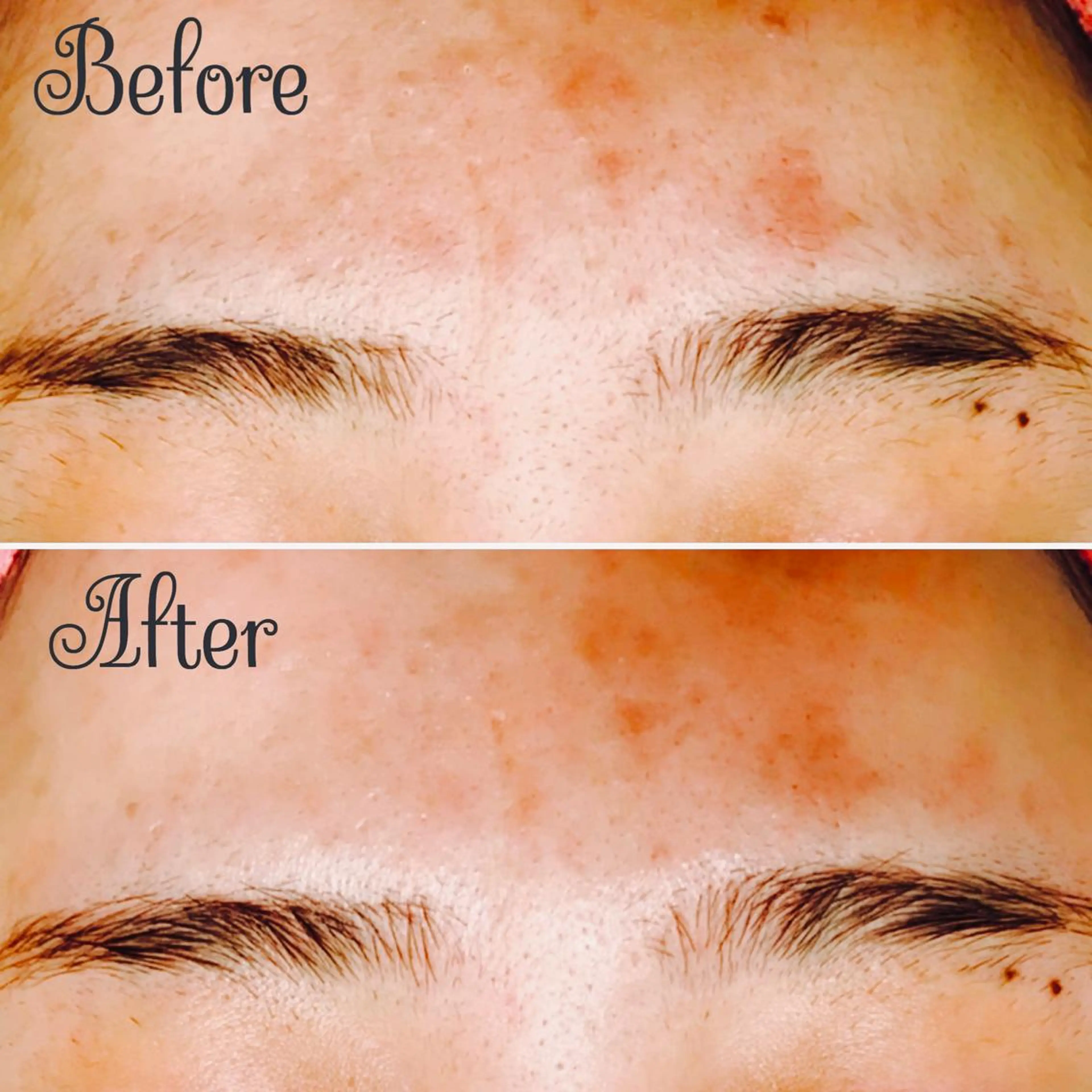 Linomalie エステ/たるみ/脱毛のエステ・リラクイメージ