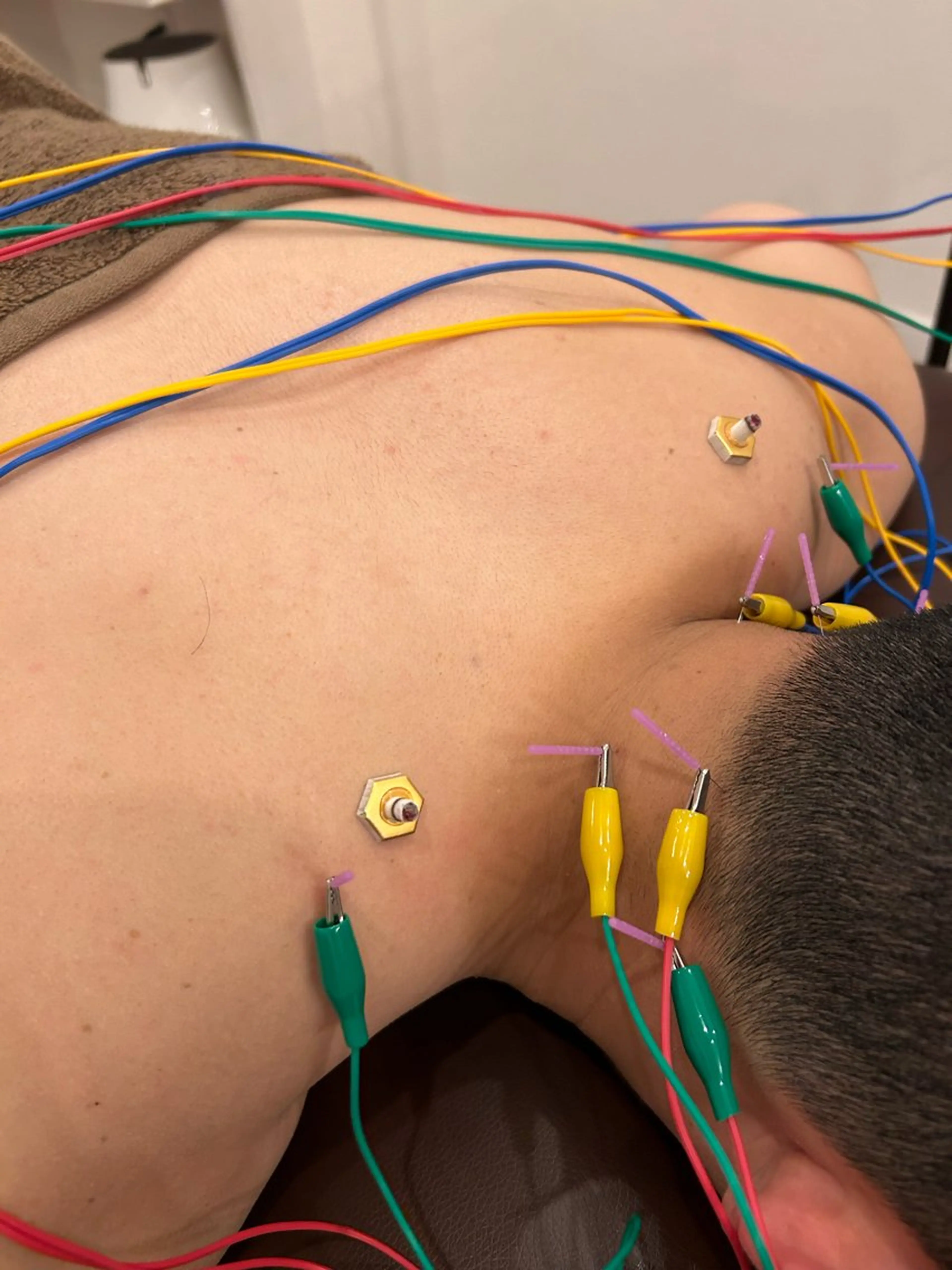 エステ リラク 肌質改善×美容鍼 ゆいのエステ・リラクイメージ