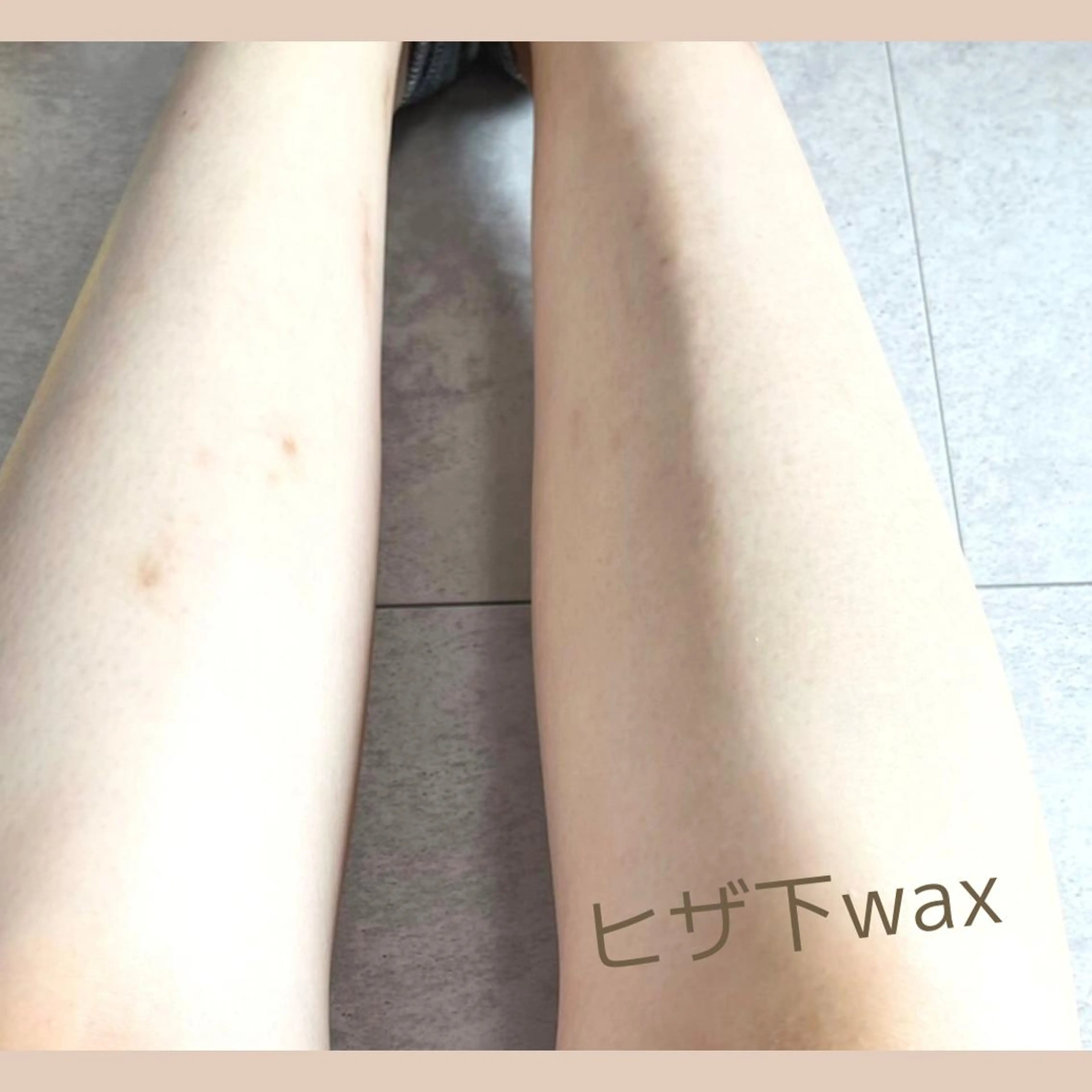 脱毛 &me ayakaのエステ・リラクイメージ