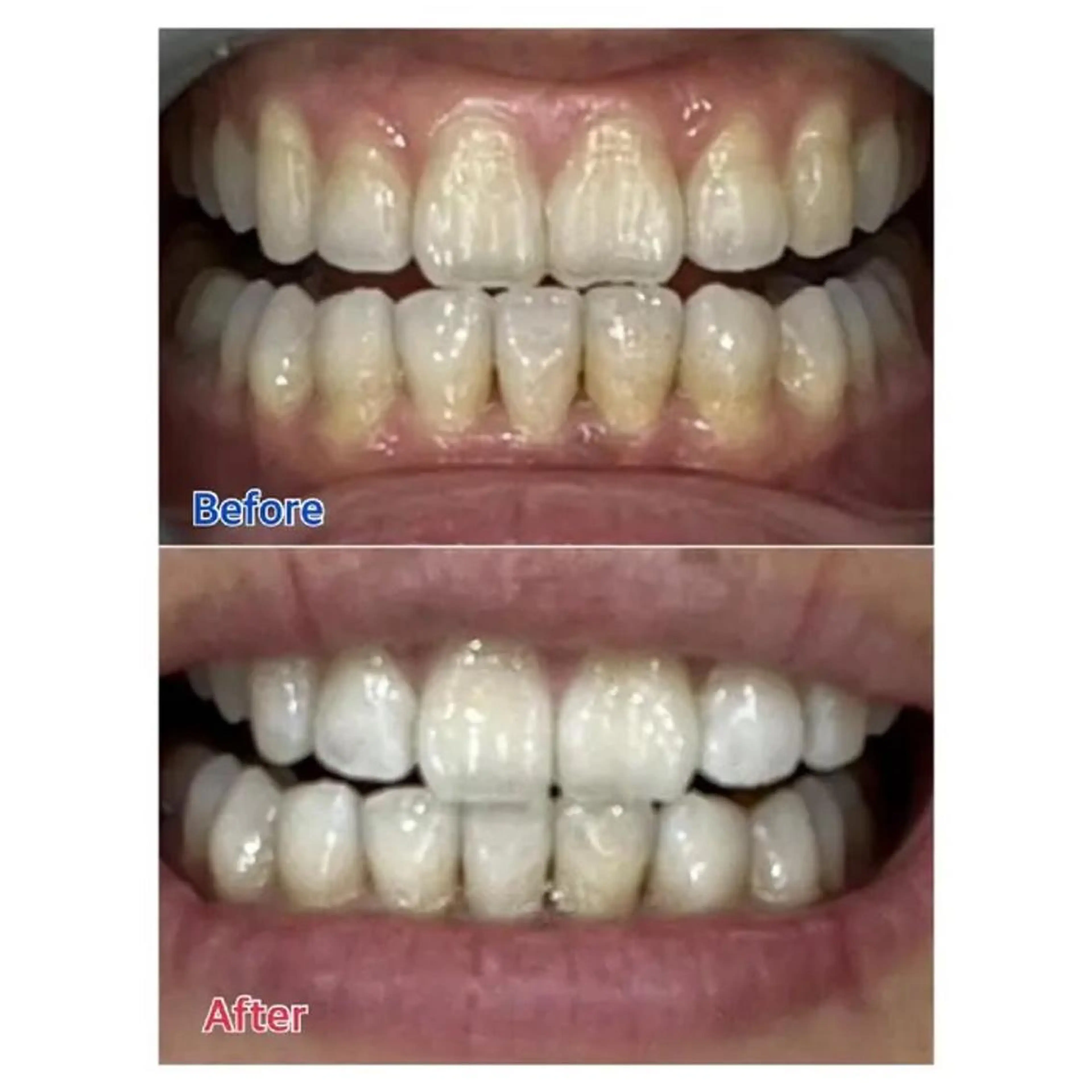 Ｍ渋谷 ホワイトニングのエステ・リラクイメージ