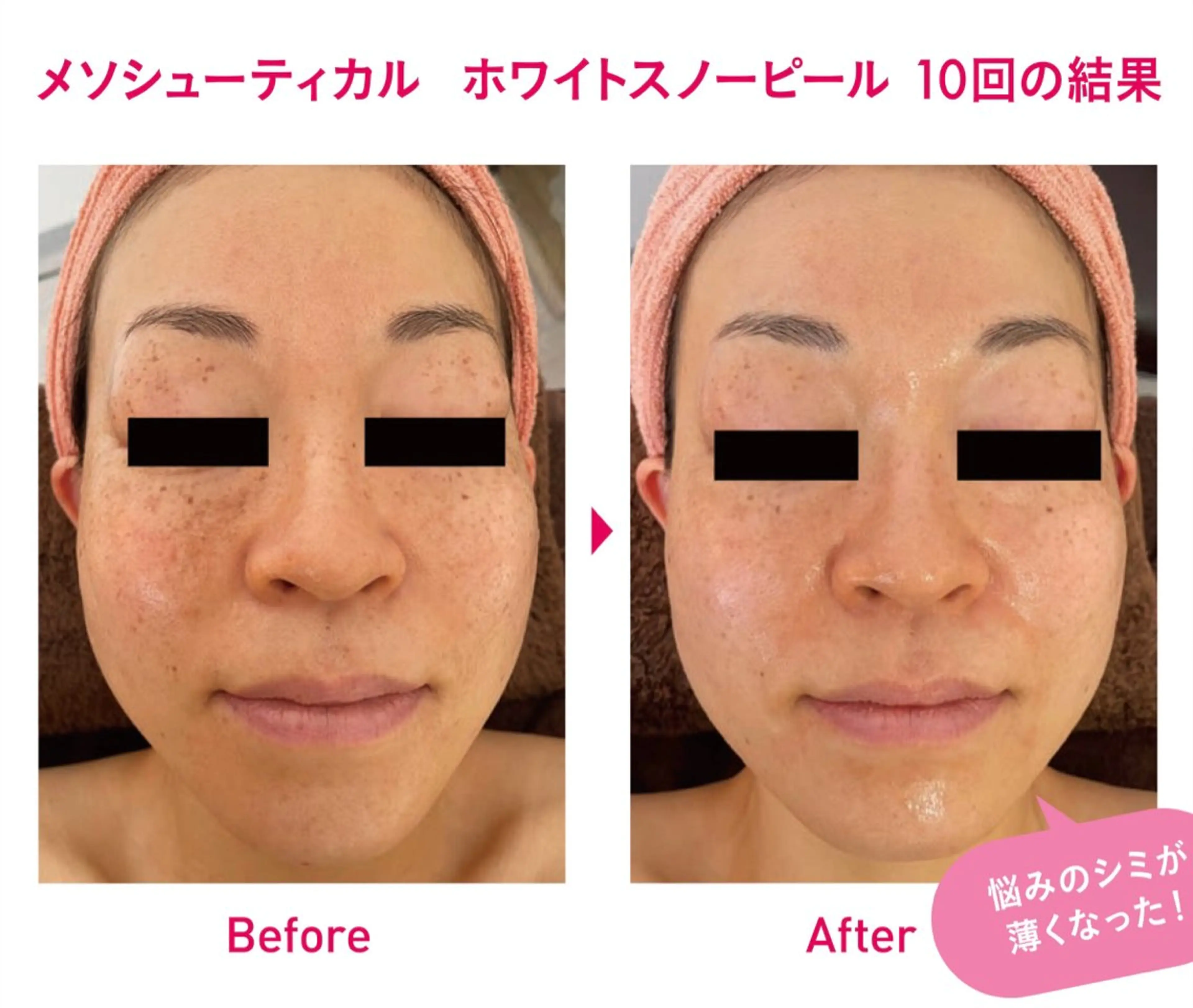 エステ MAUM-美 caresalon-のエステ・リラクイメージ