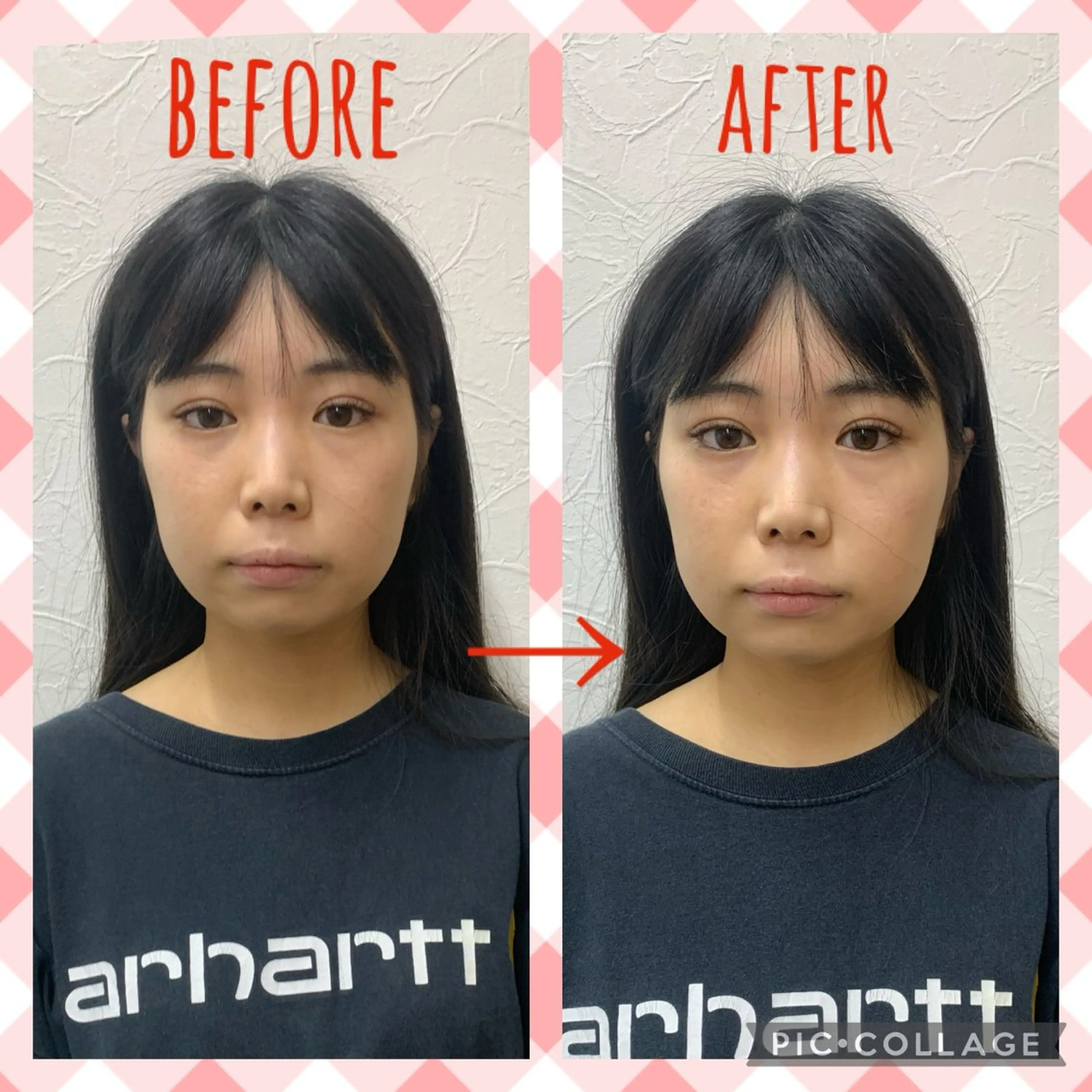 NO.10 整骨院のエステ・リラクイメージ