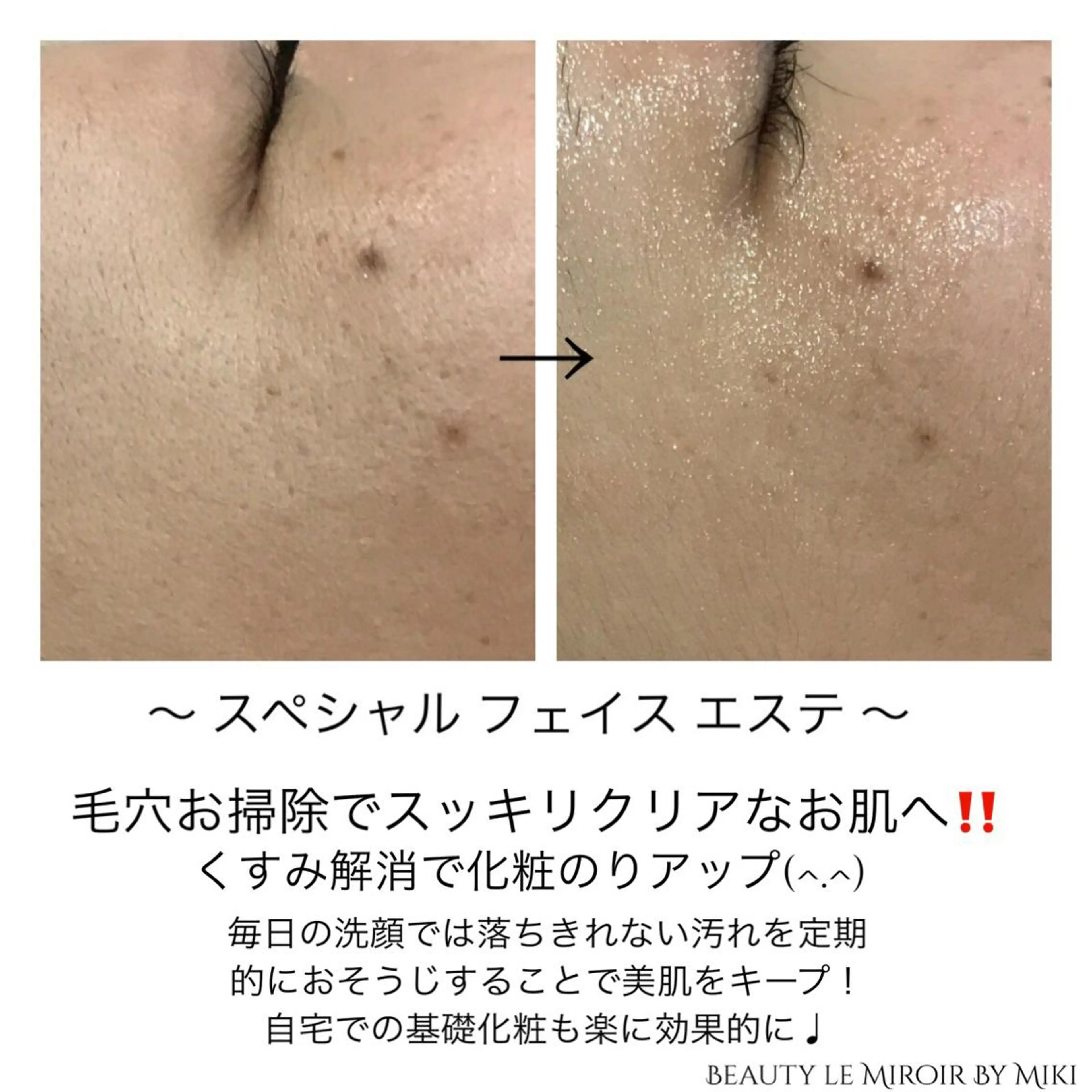 ビューティー ミロワールのエステ・リラクイメージ