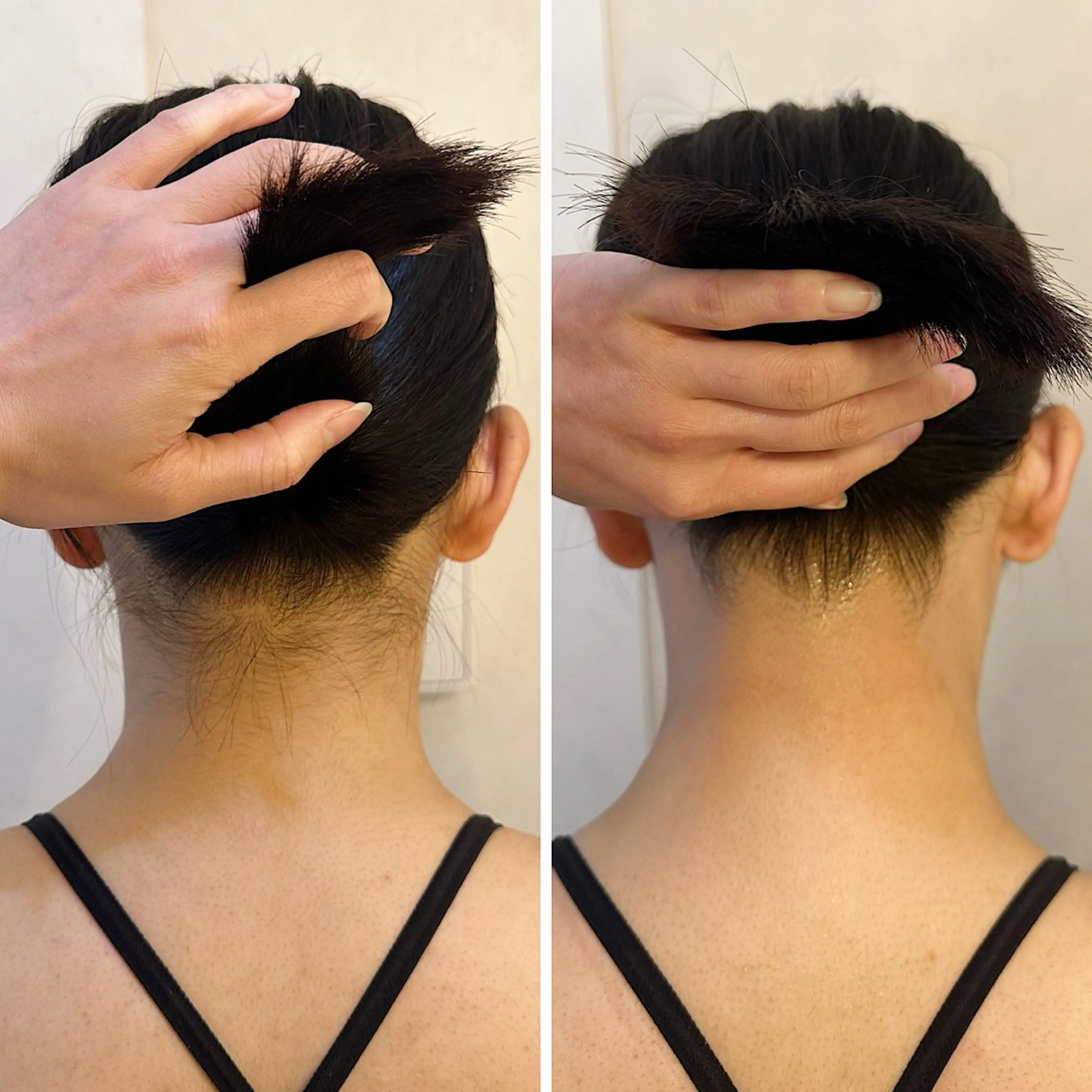 脱毛 うなじ脱毛/美肌脱毛 LABELのエステ・リラクイメージ