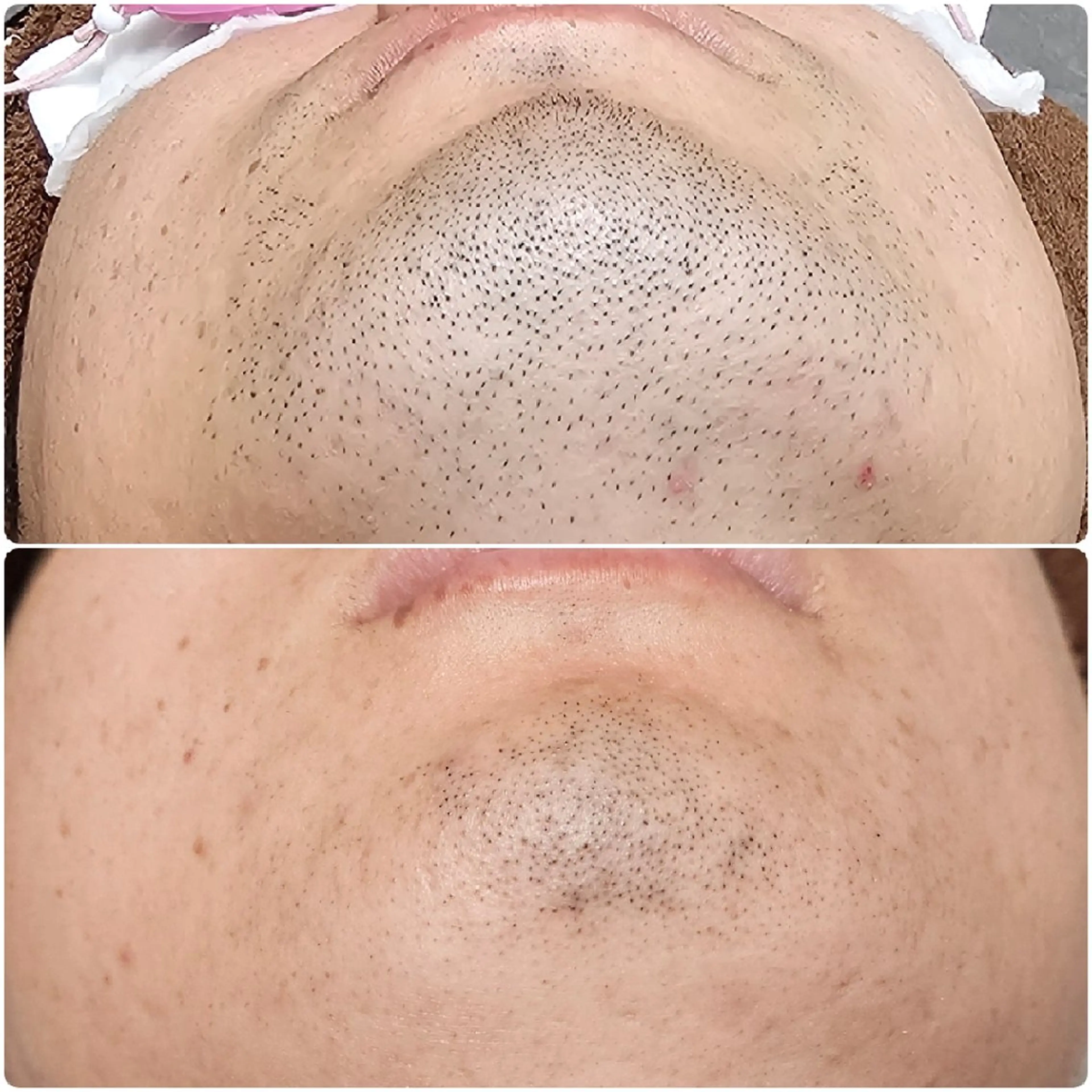 メンズ Iry アイリーのエステ・リラクイメージ