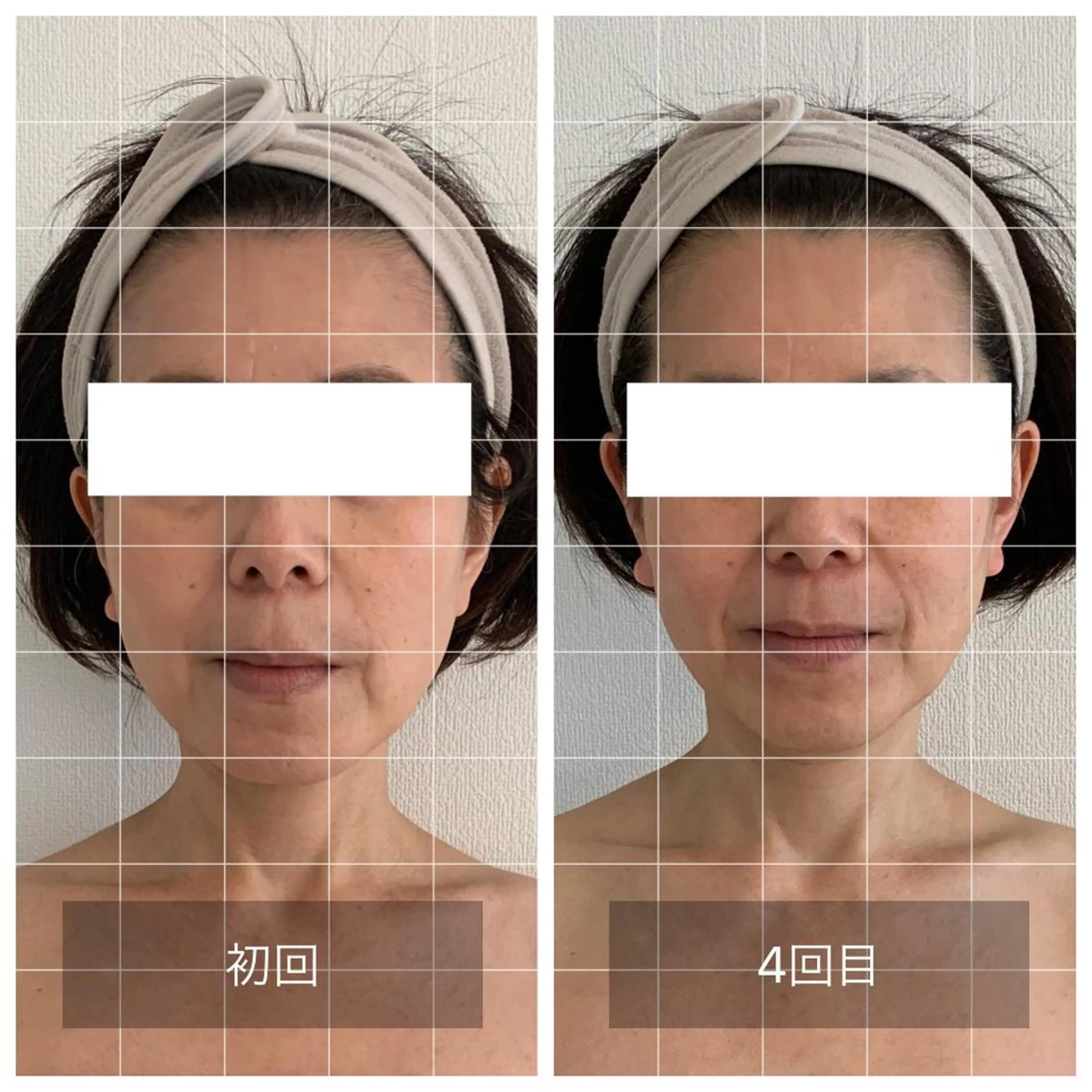 Eminy. HITOMIのエステ・リラクイメージ