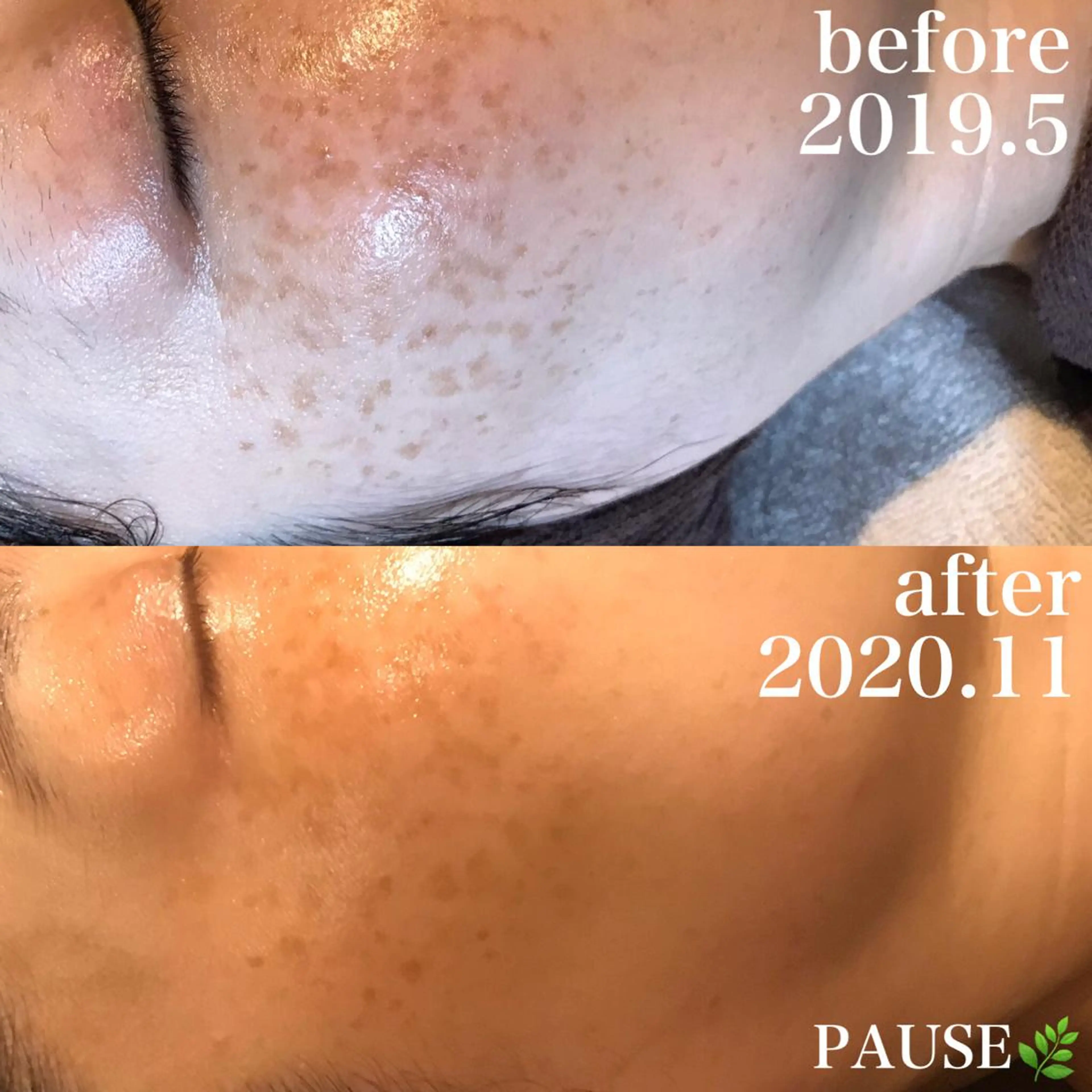 エステ 浜野 恵美のエステ・リラクイメージ