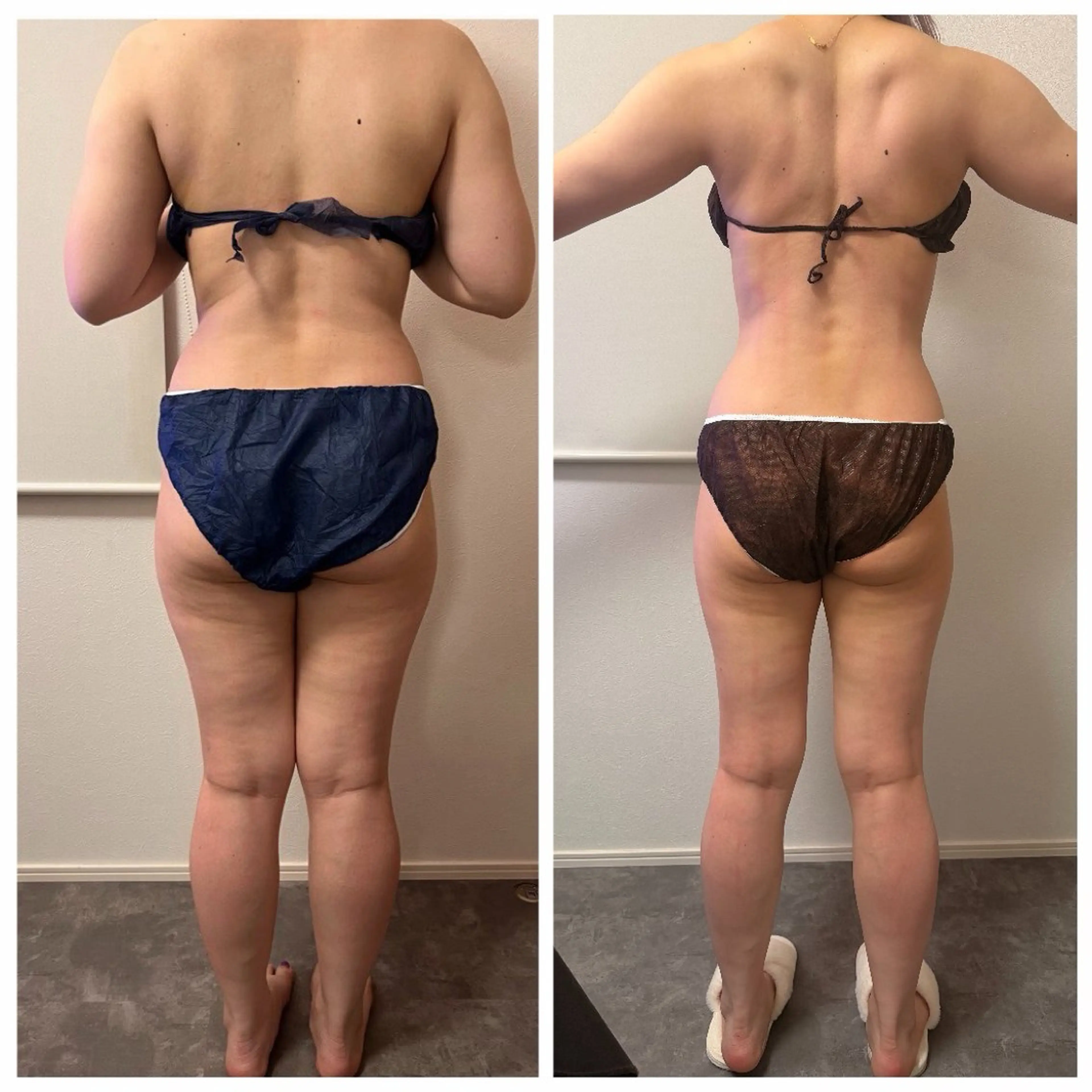 Raviy 【痩身・韓国肌管理】のエステ・リラクイメージ