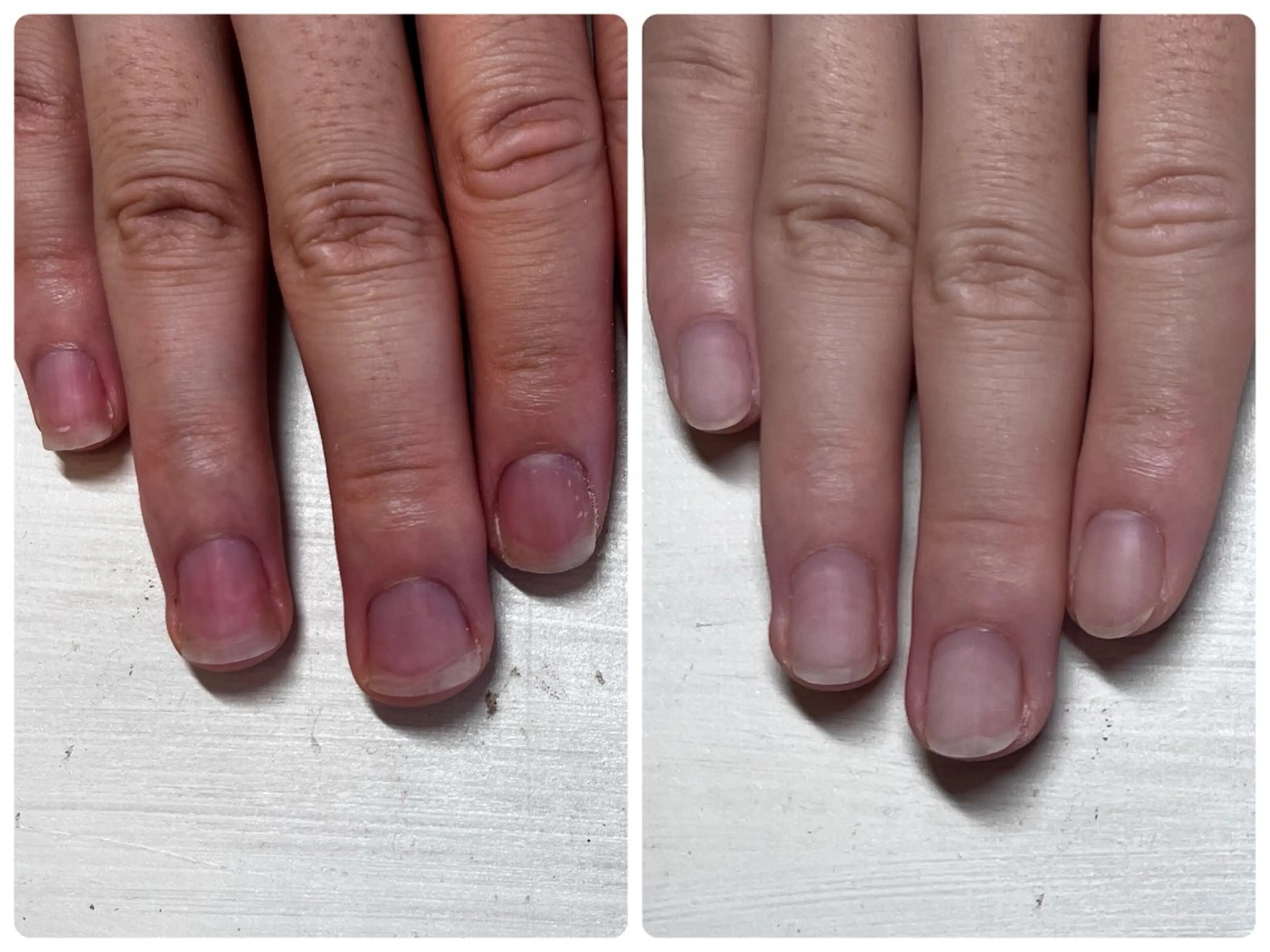 ネイル ピンク 深爪矯正・自爪育成 ヴェールリムのネイルデザイン