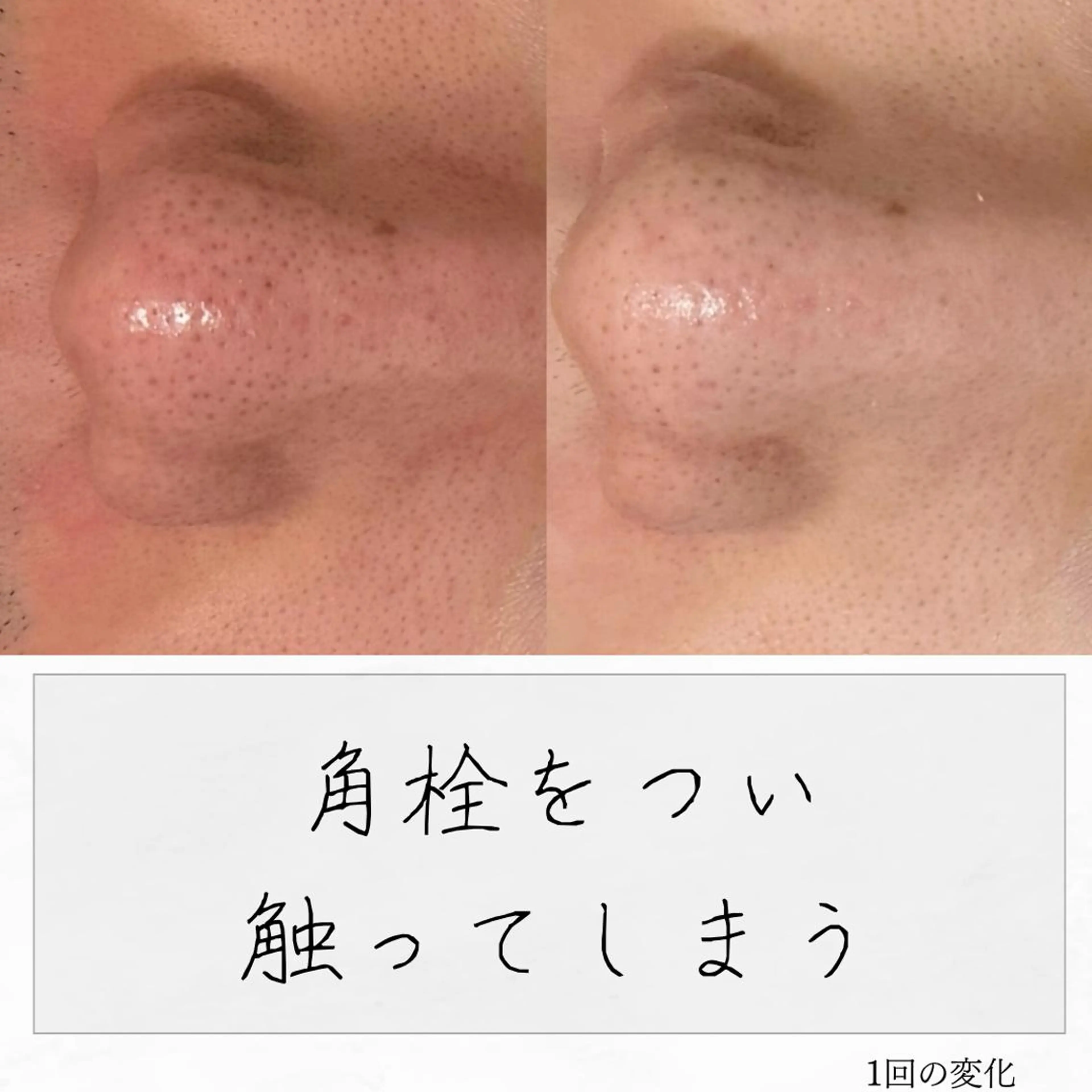 ニキビ経験者が施術 する専門サロン🌻のエステ・リラクイメージ