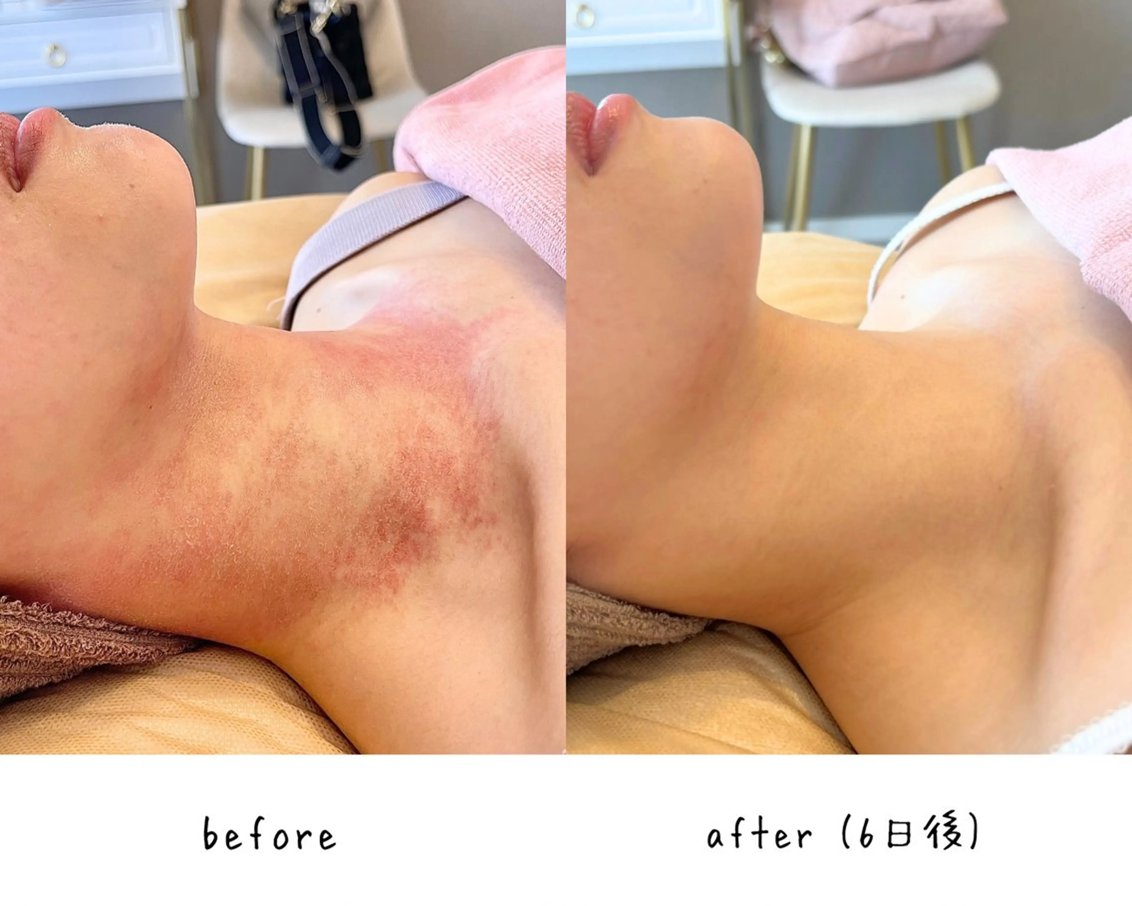 肌質改善🌿 彩也乃のエステ・リラクイメージ