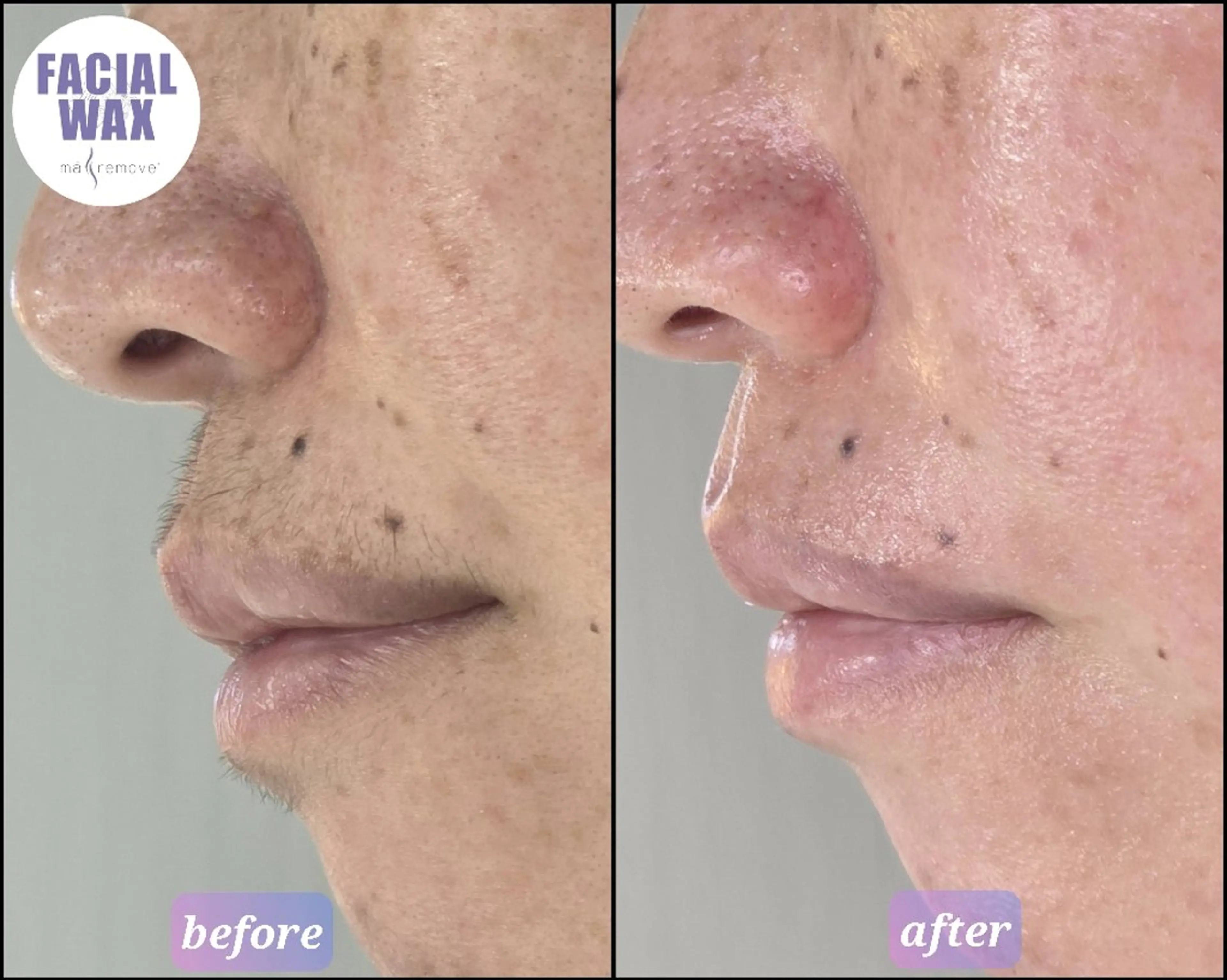 エステ facial salon Lily所属・salon Lilyのエステ・リラクイメージ