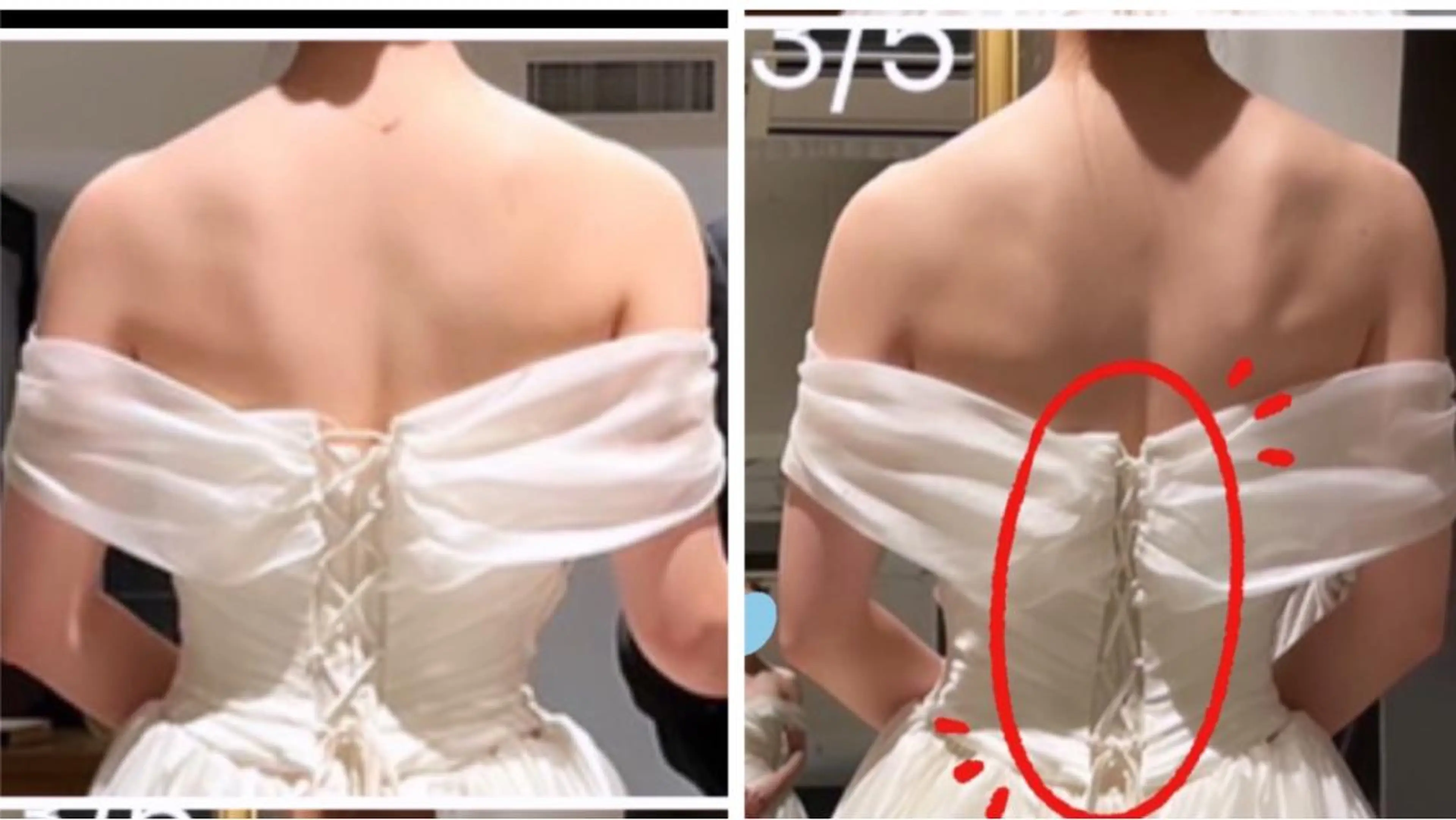 エステ リラク 脱毛・エステサロン LuLuNのエステ・リラクイメージ