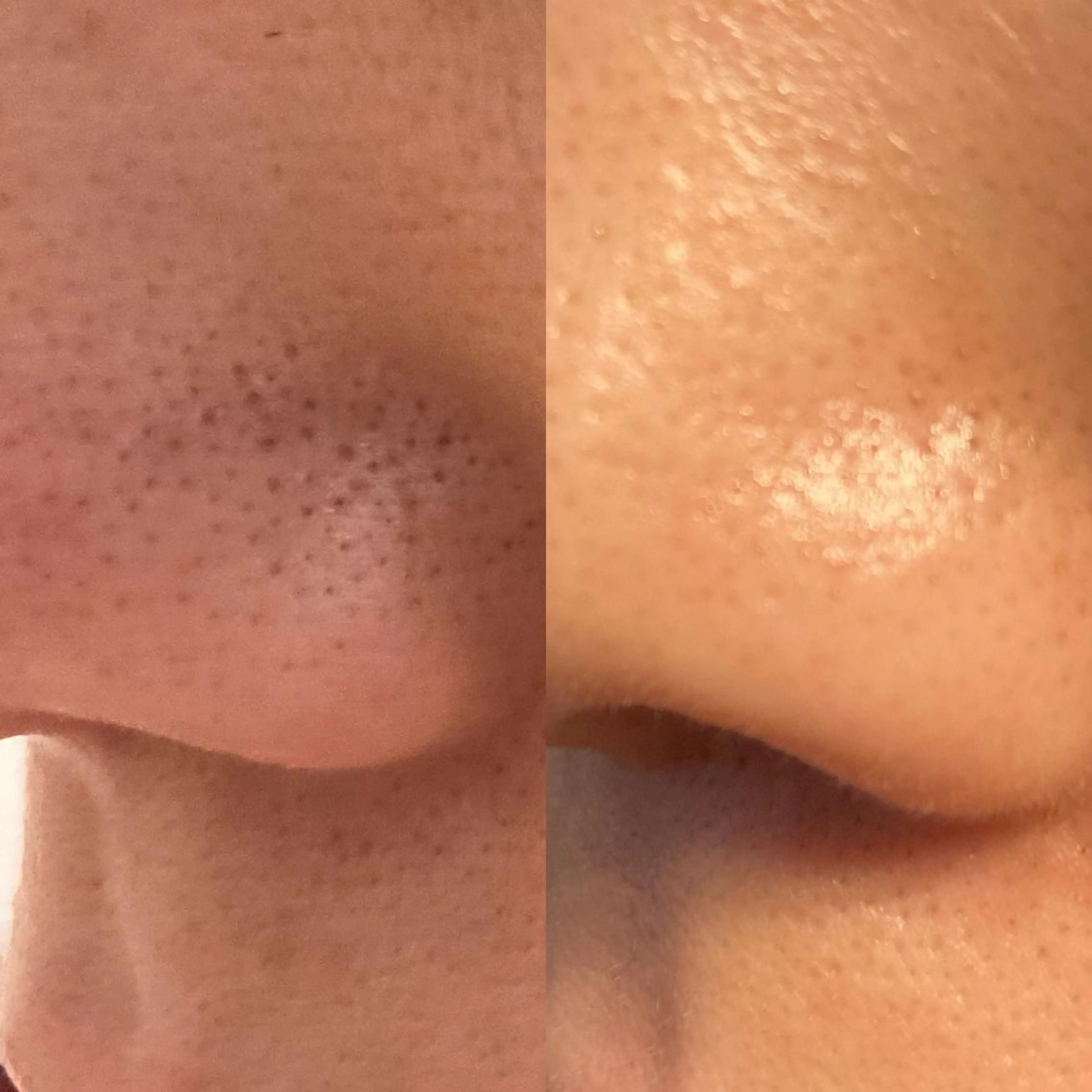 Pono （ポノ）のエステ・リラクイメージ