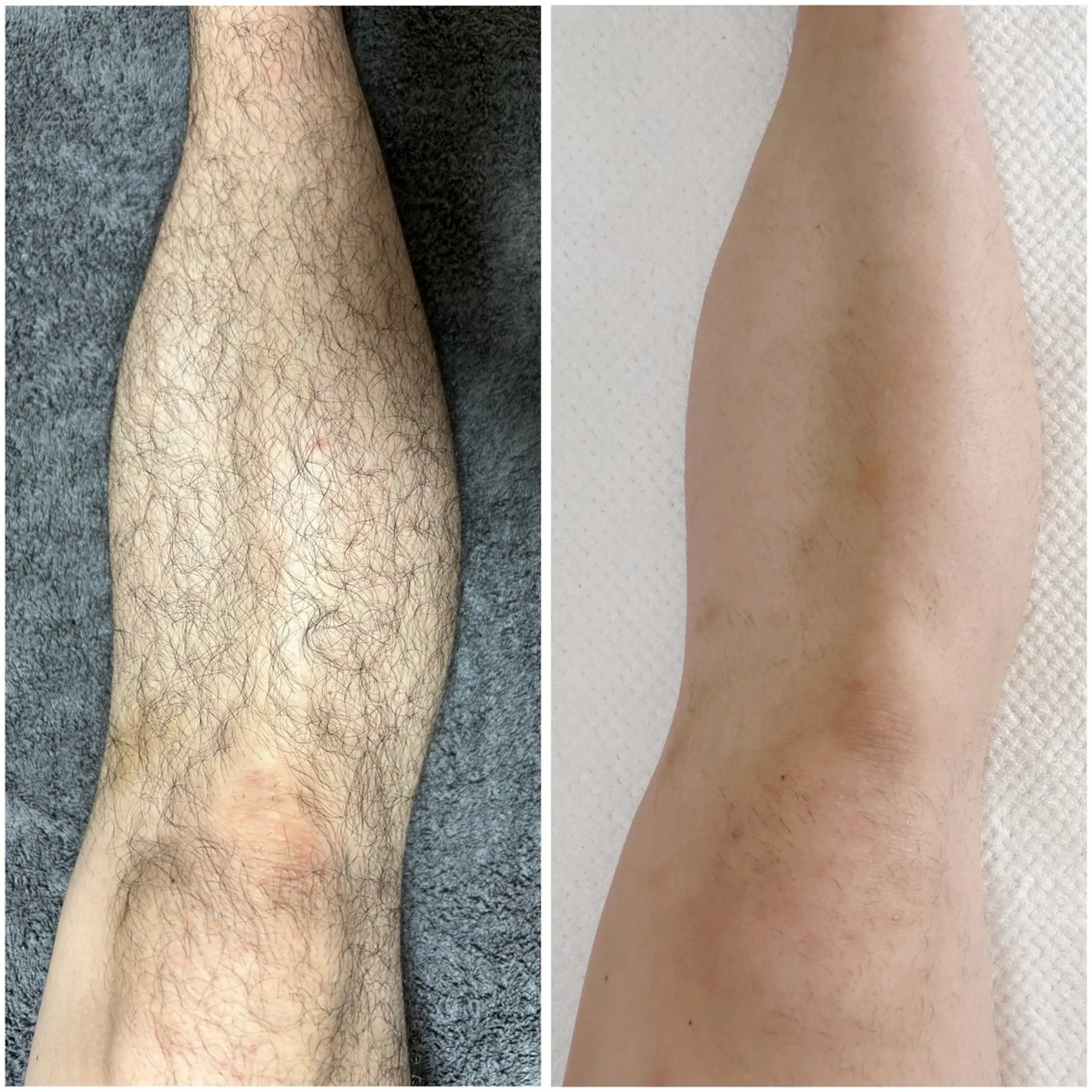 脱毛・ホワイトニング 耳ツボ・美白・毛穴のその他イメージ