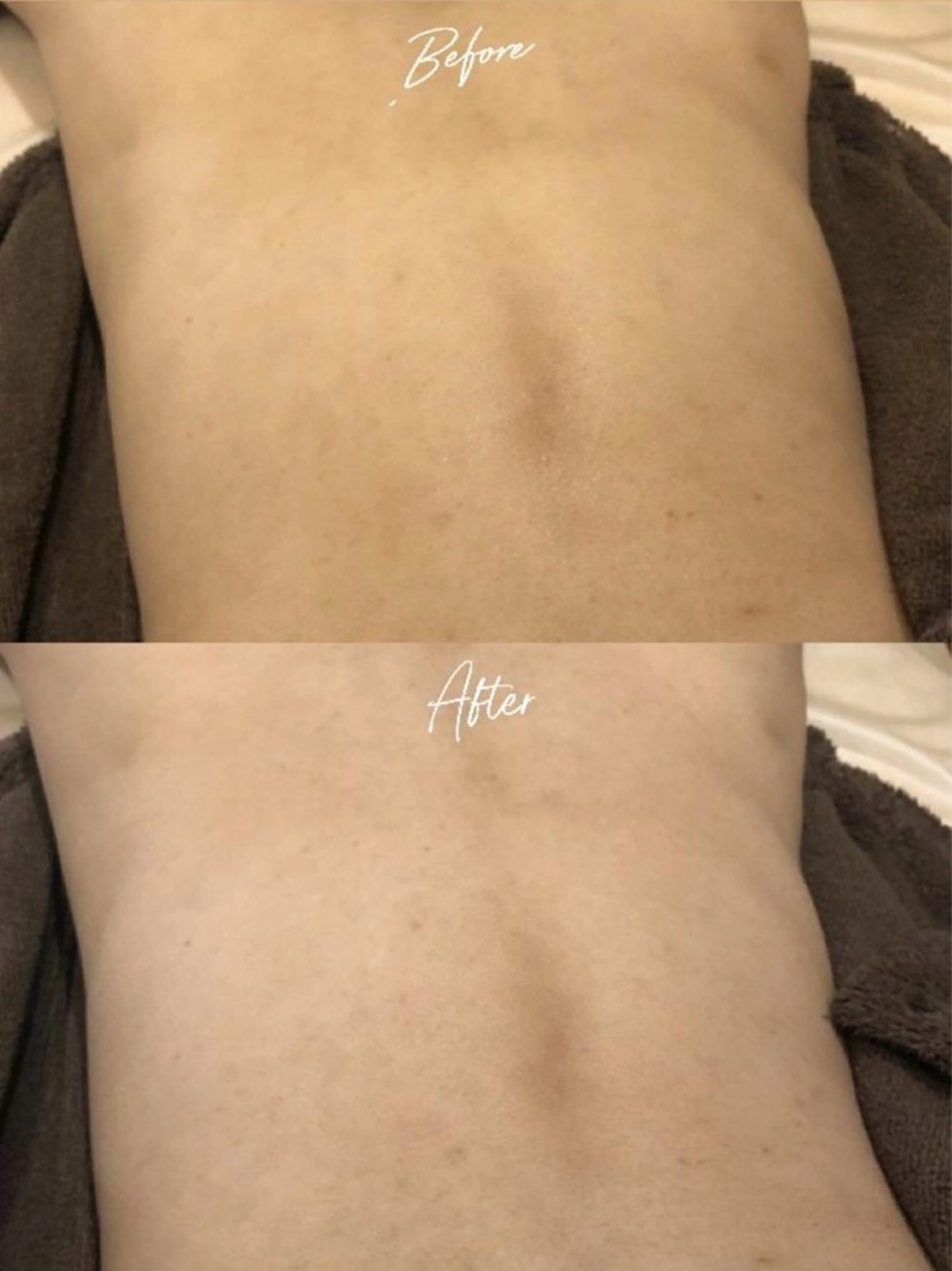 脱毛／肌質改善 《ulula~梟》のエステ・リラクイメージ