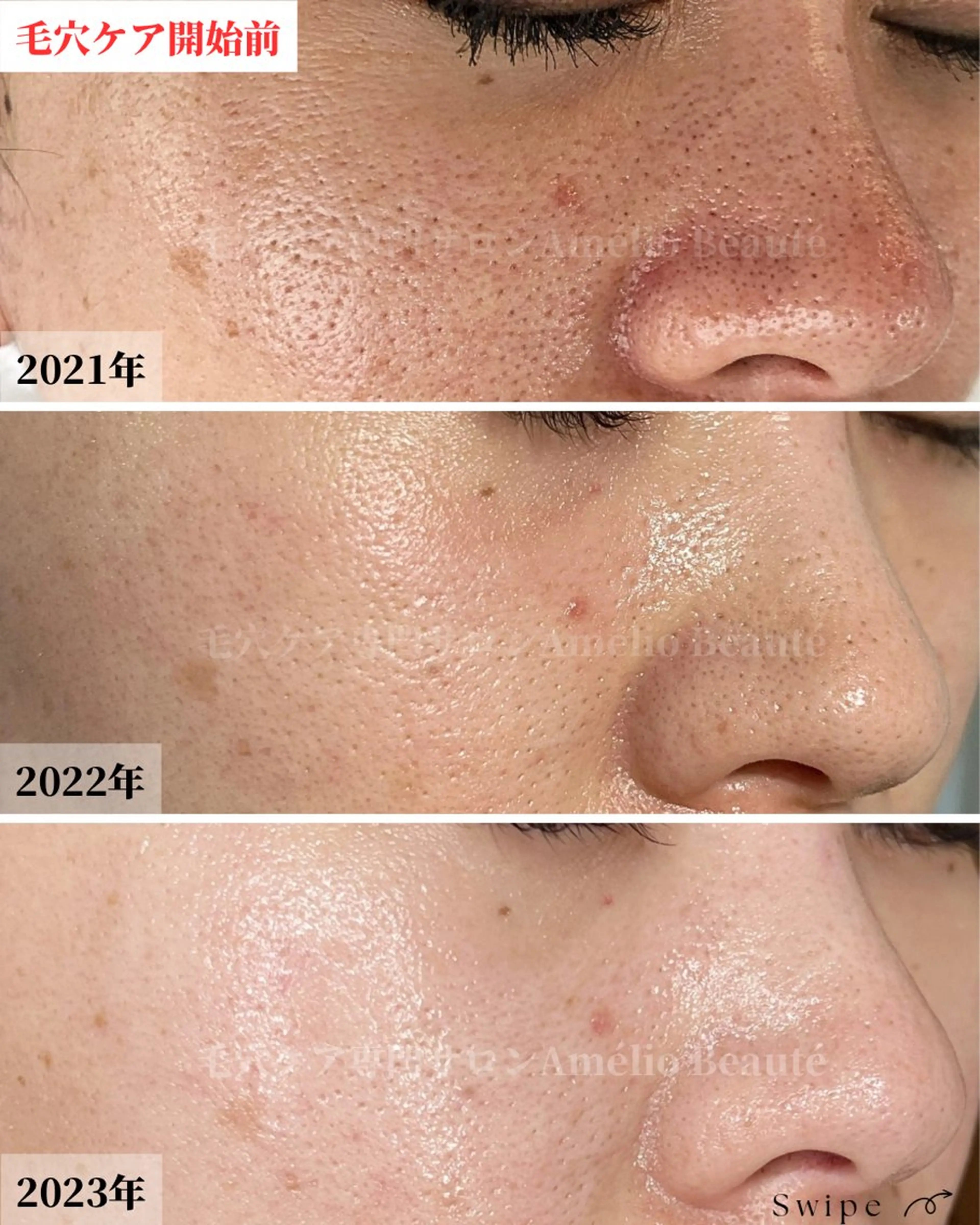 メンズ 毛穴ケア専門サロン アメリオボーテのその他イメージ