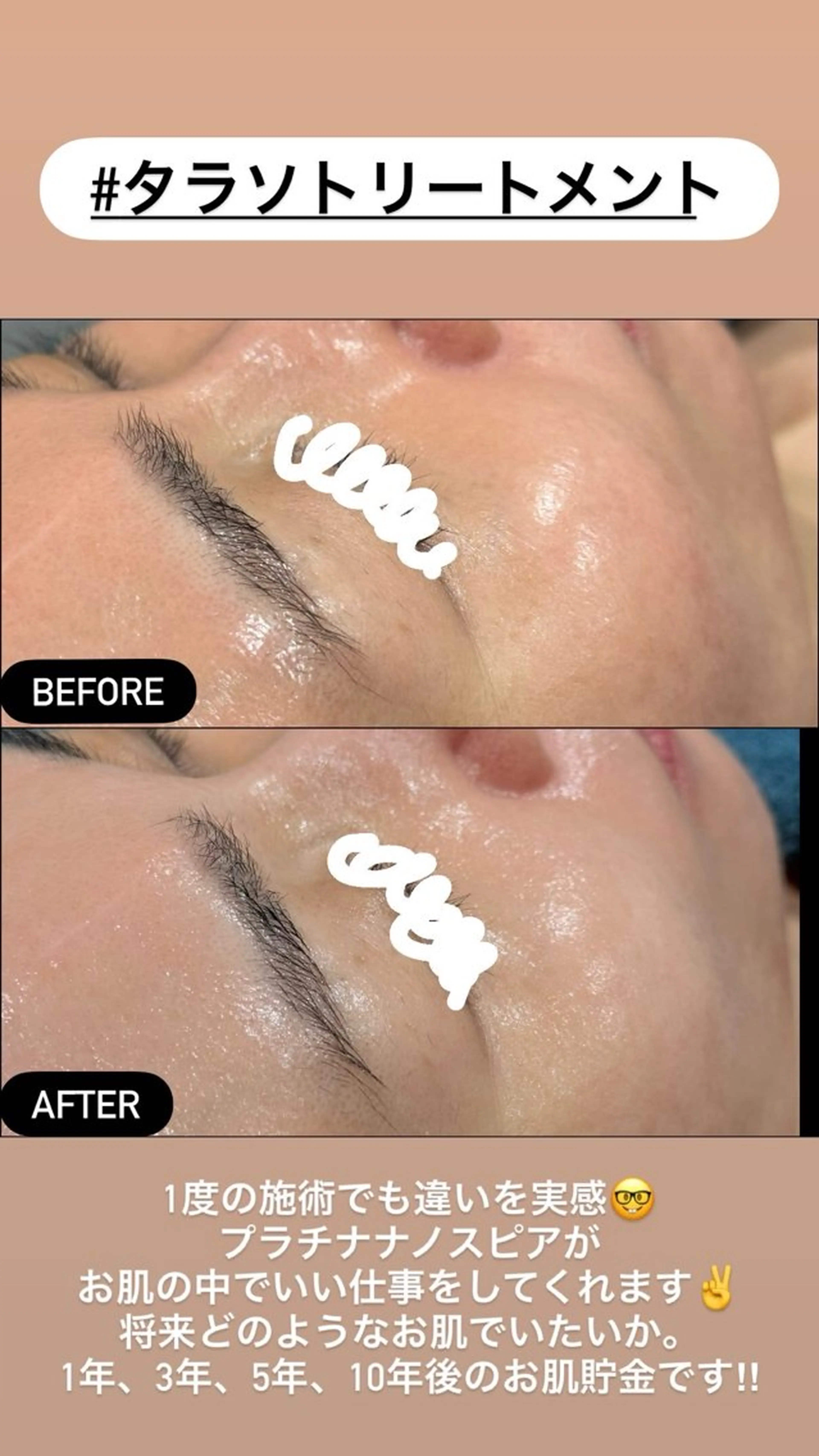 エステ LiZA エステティックサロンのエステ・リラクイメージ