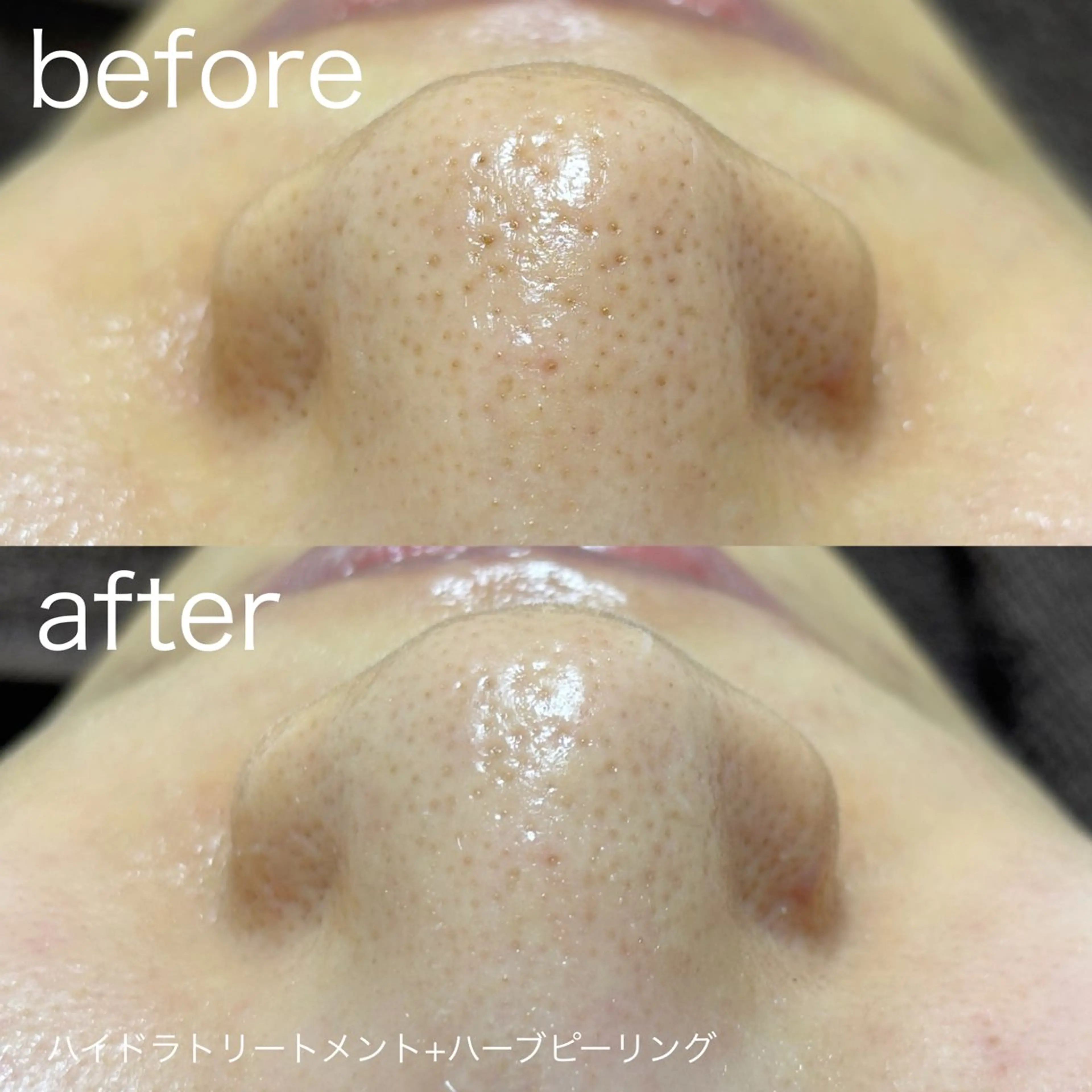 その他 lulularico Yuのエステ・リラクイメージ