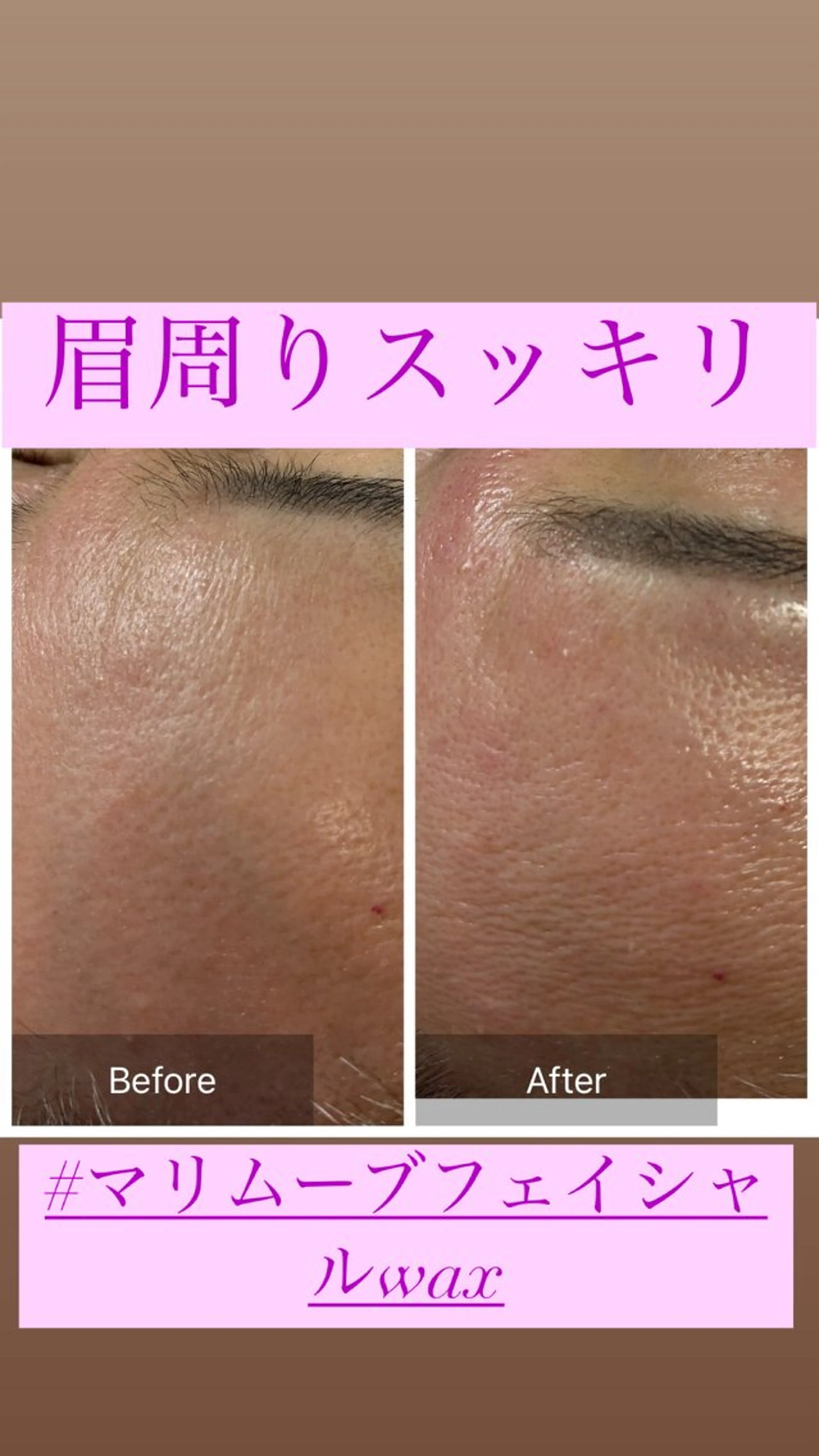 アイブロウ 脱毛 産毛専門店 Bittoのエステ・リラクイメージ