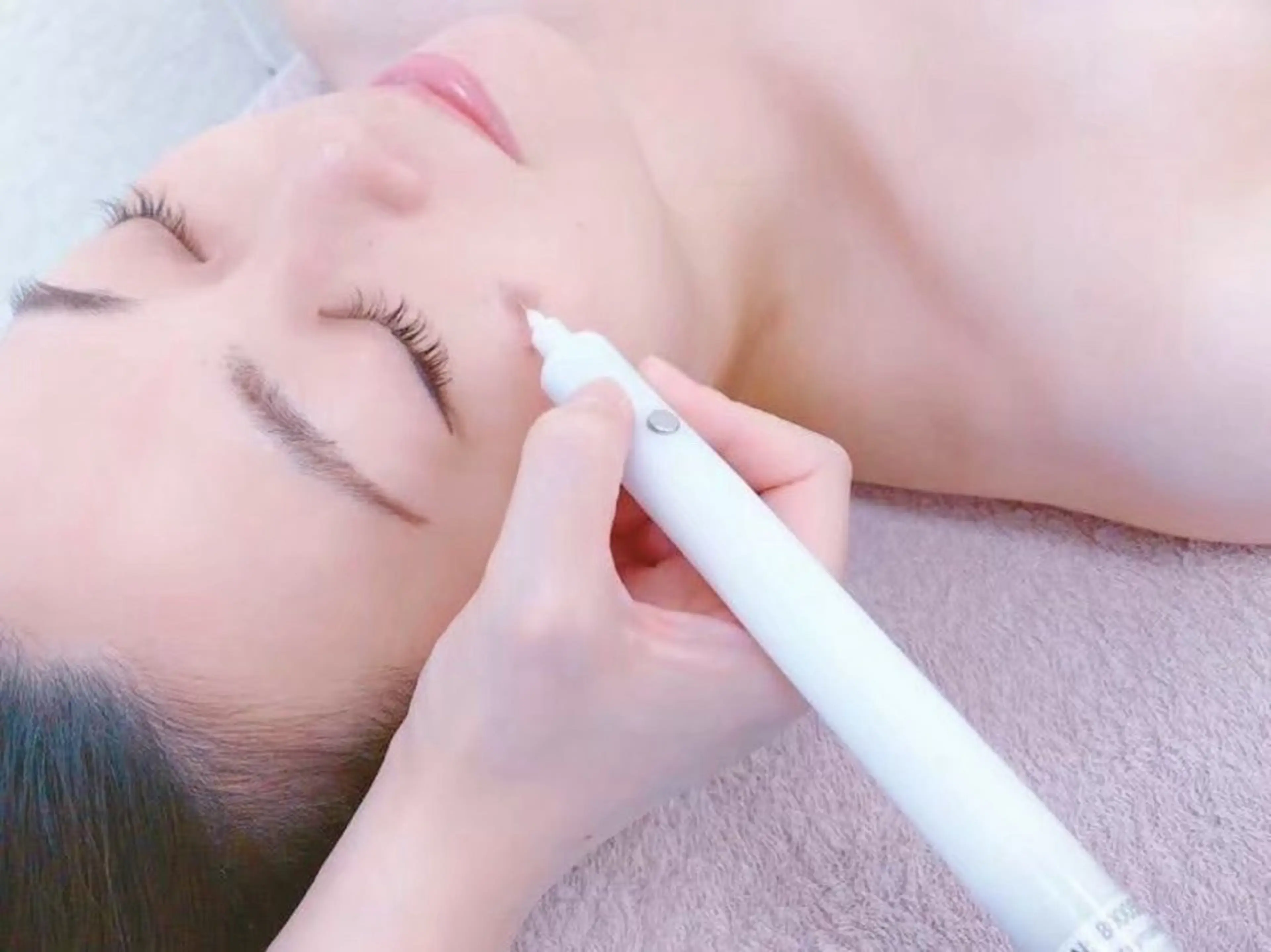 《初回限定》シミケアコース（保湿パック付）▶︎ 痛み、ダウンタイム無し！の安心シミケア10分あて放題　施術後メイク🆗の写真