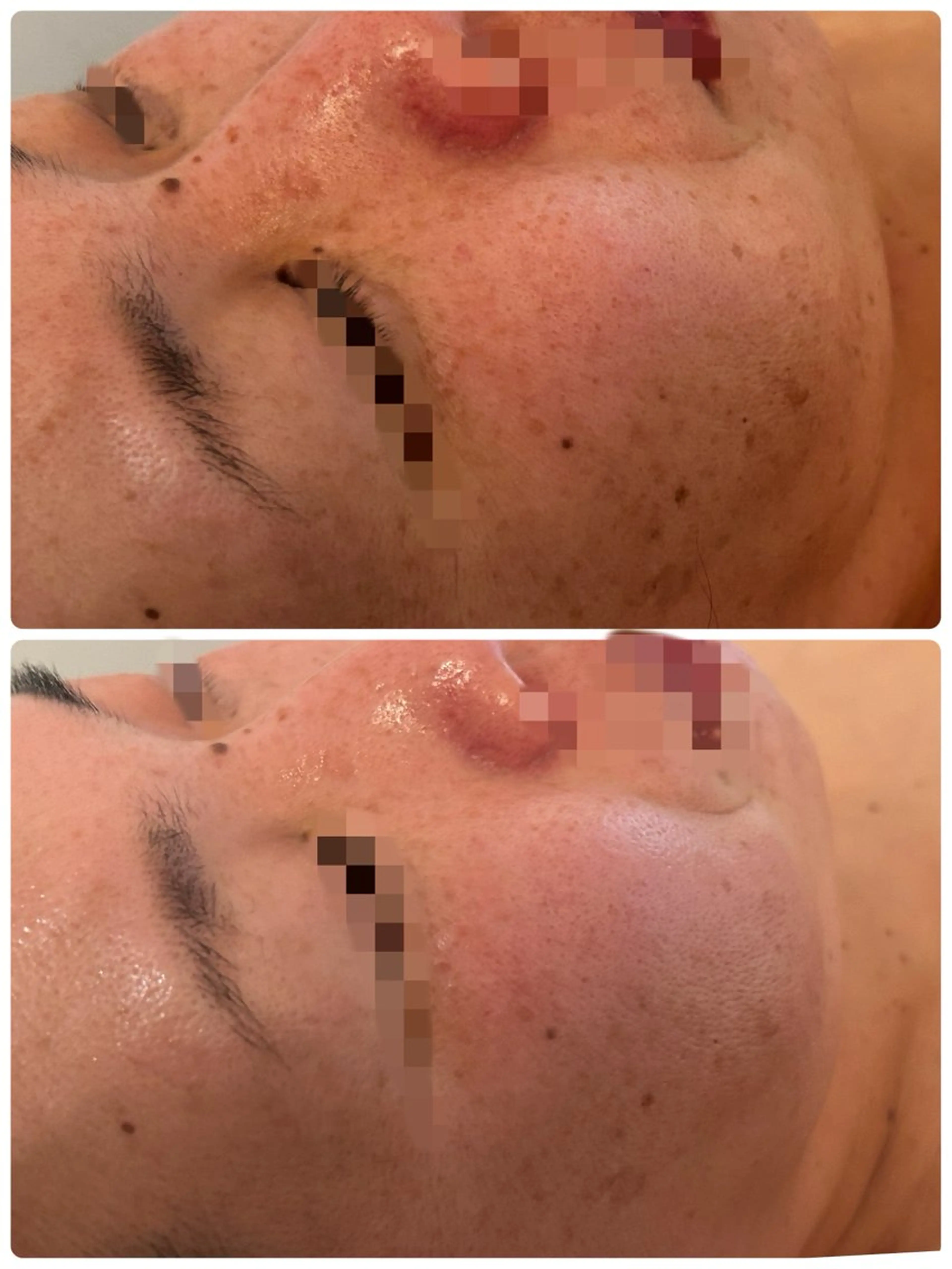 エステ リラク メナード　フェイシャルサロン　鳥飼野々店所属・石川 捺季のエステ・リラクイメージ