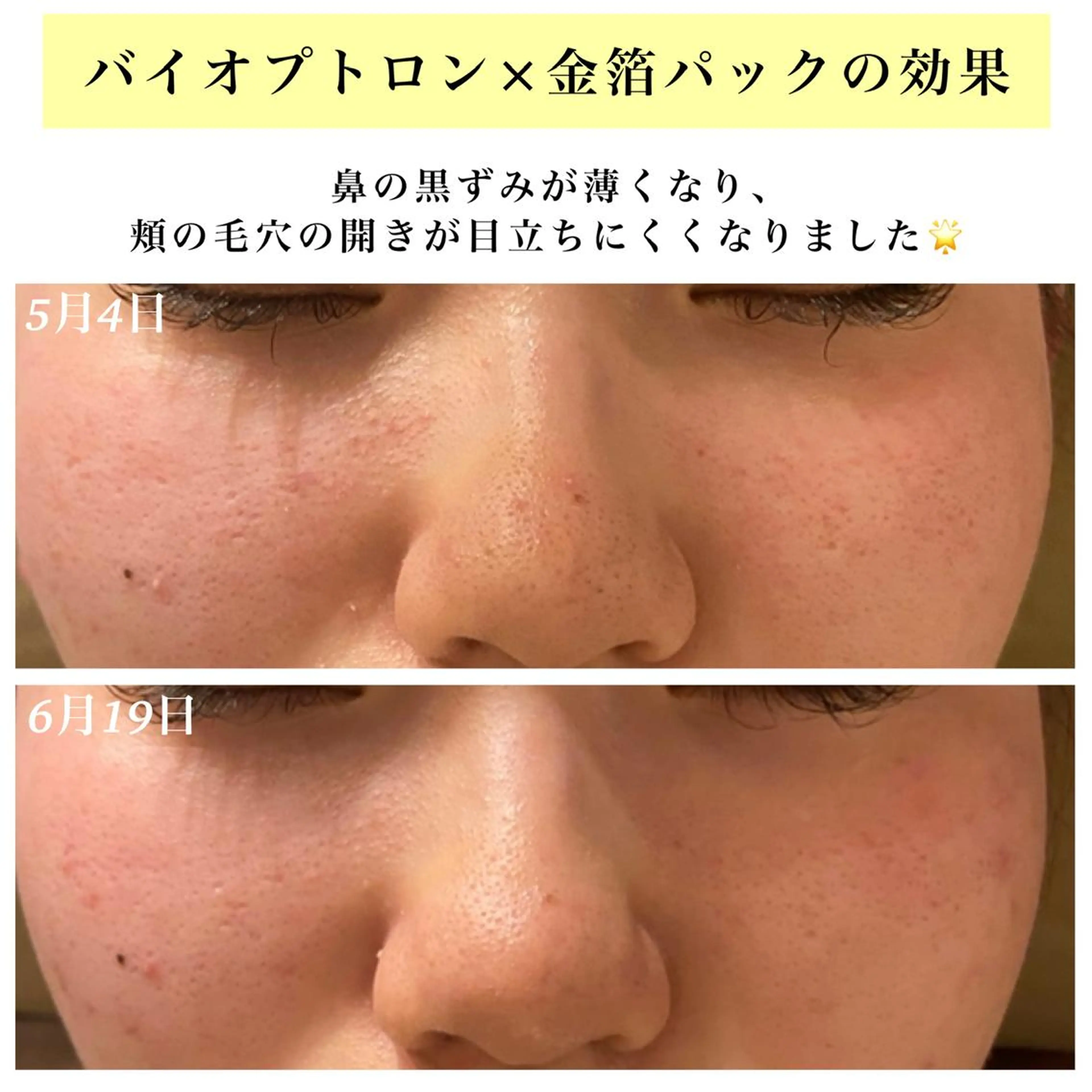 エステ リラク Bellesthe (ベルエステ)のエステ・リラクイメージ