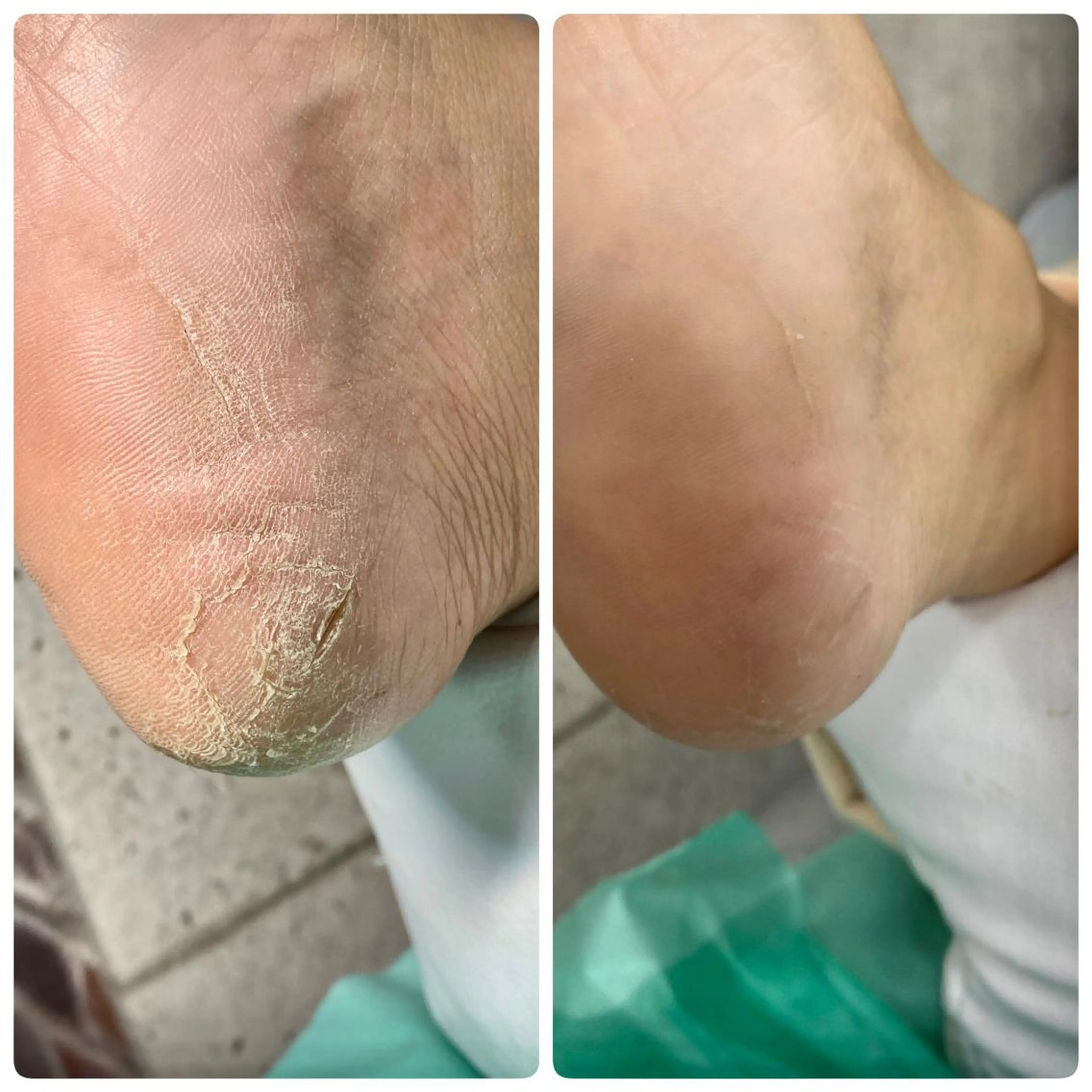 東京巻き爪アカデミー所属・東京巻き爪 アカデミーのエステ・リラクイメージ