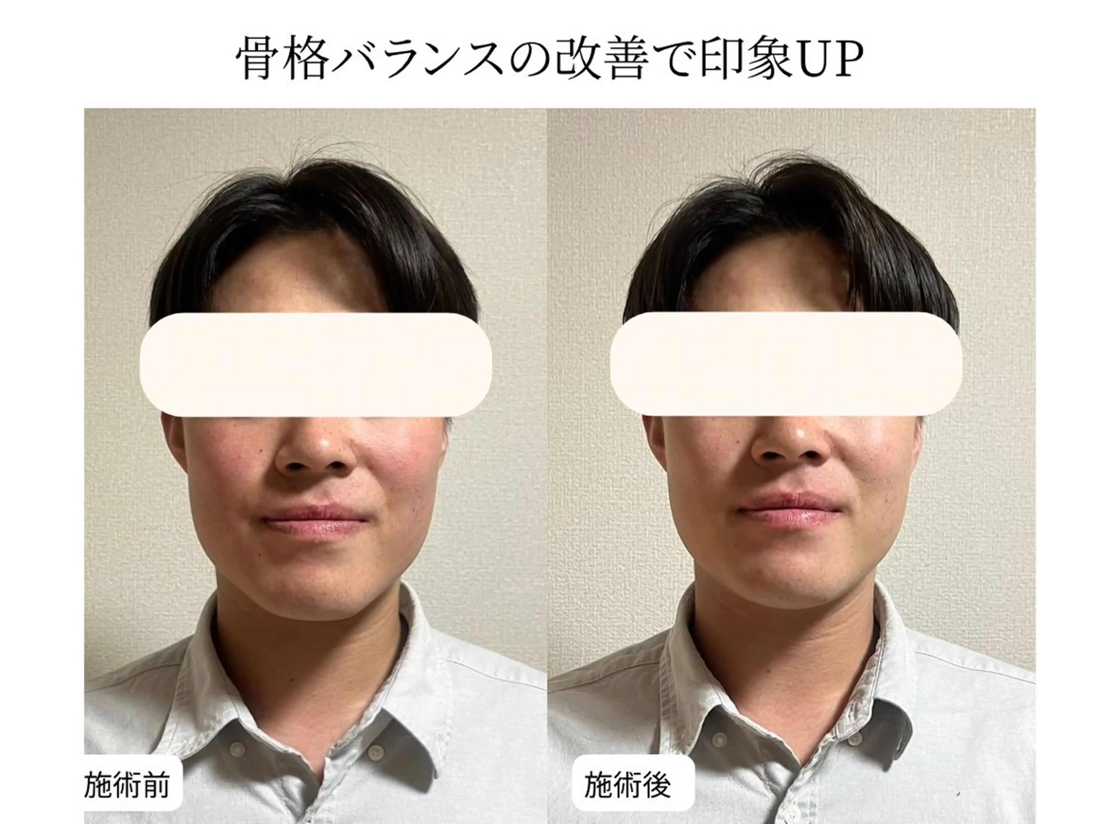 小顔矯正×毛穴サロン DRRAMSPA町田のエステ・リラクイメージ