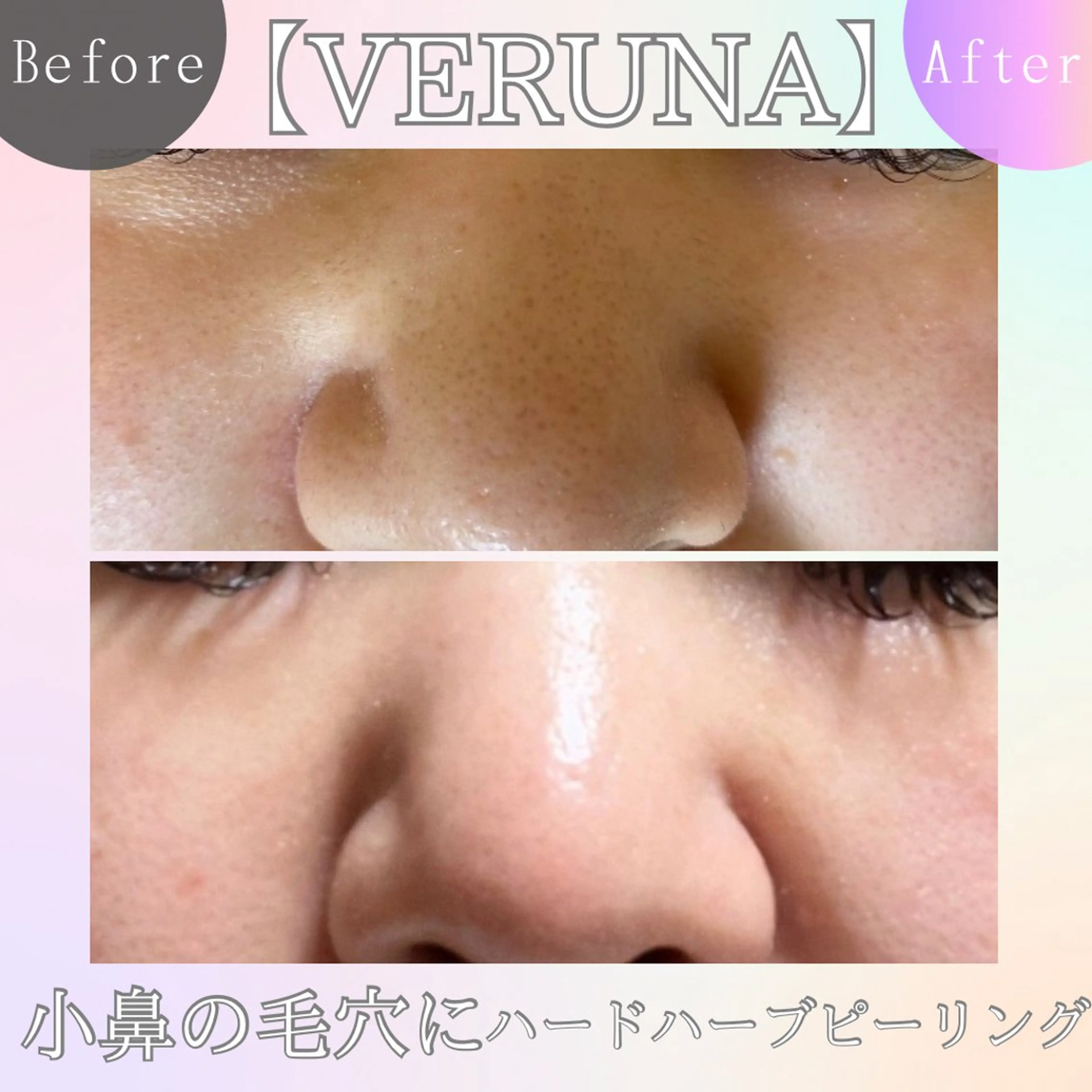 エステ 毛穴改善サロン d'Alba大阪住吉のエステ・リラクイメージ