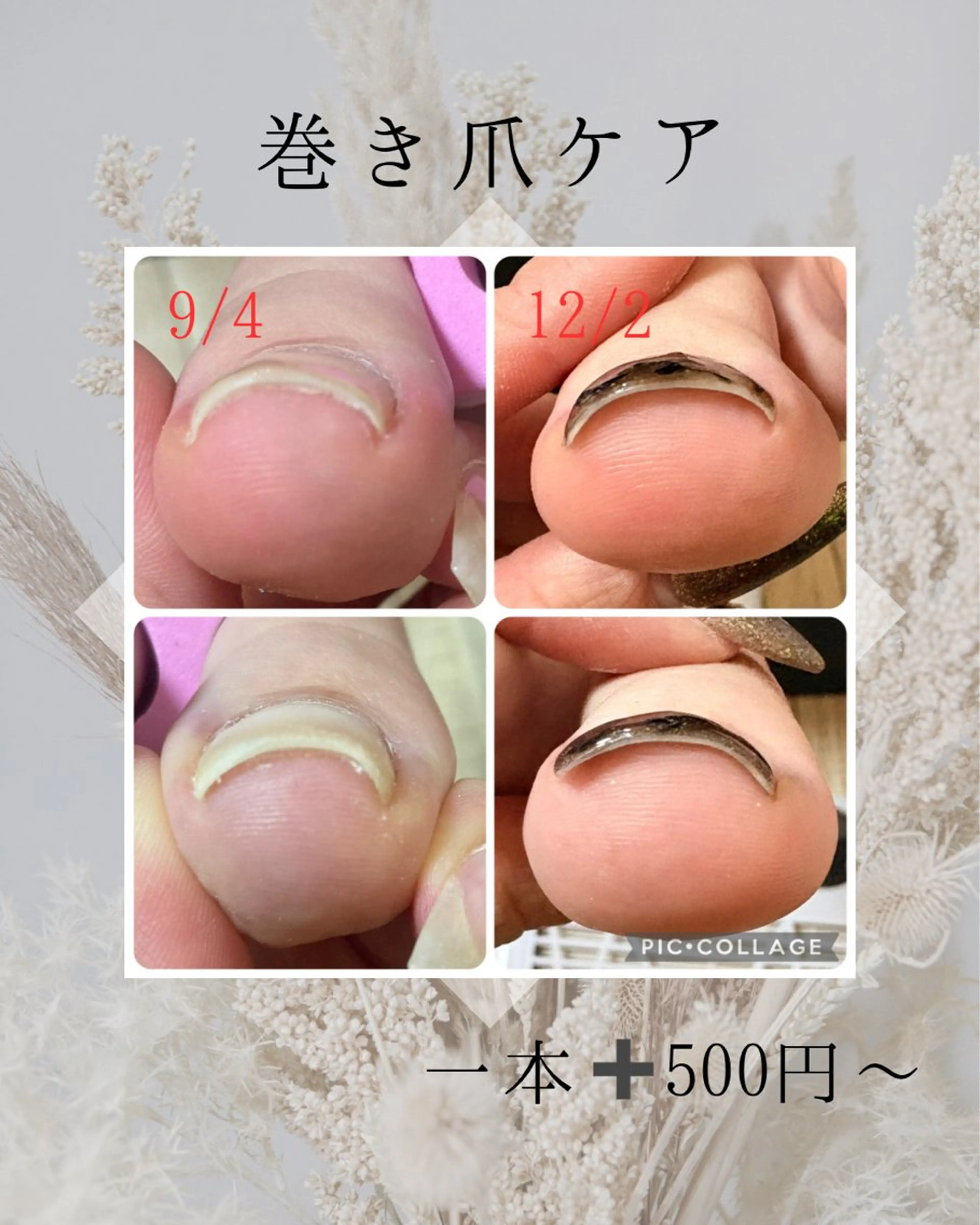 ネイル 寺山 千鶴のネイルデザイン