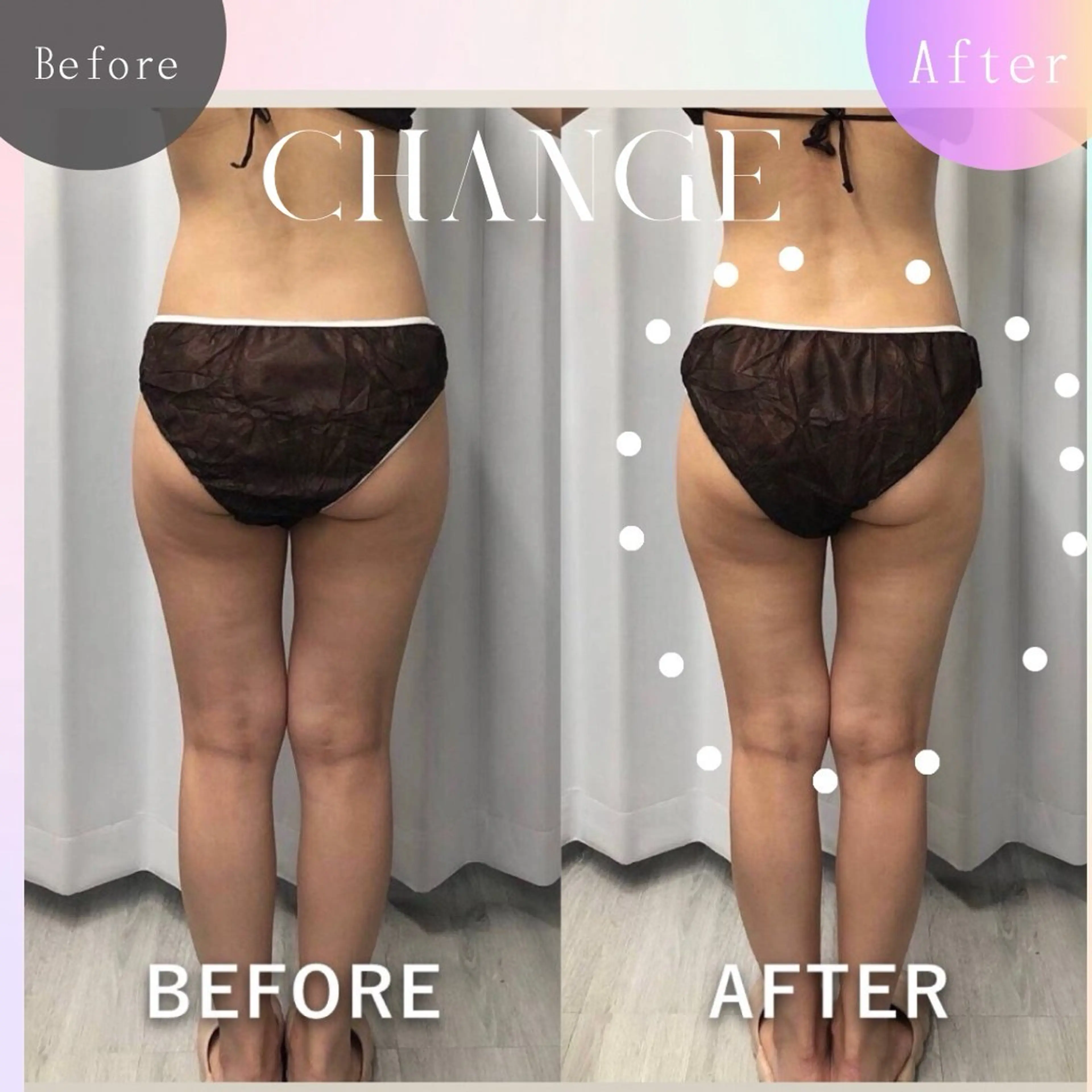 美容整体・塗る漢方・フェイシャルRechica所属・痩身・脱毛・肌管理 Rechica心斎橋のエステ・リラクイメージ