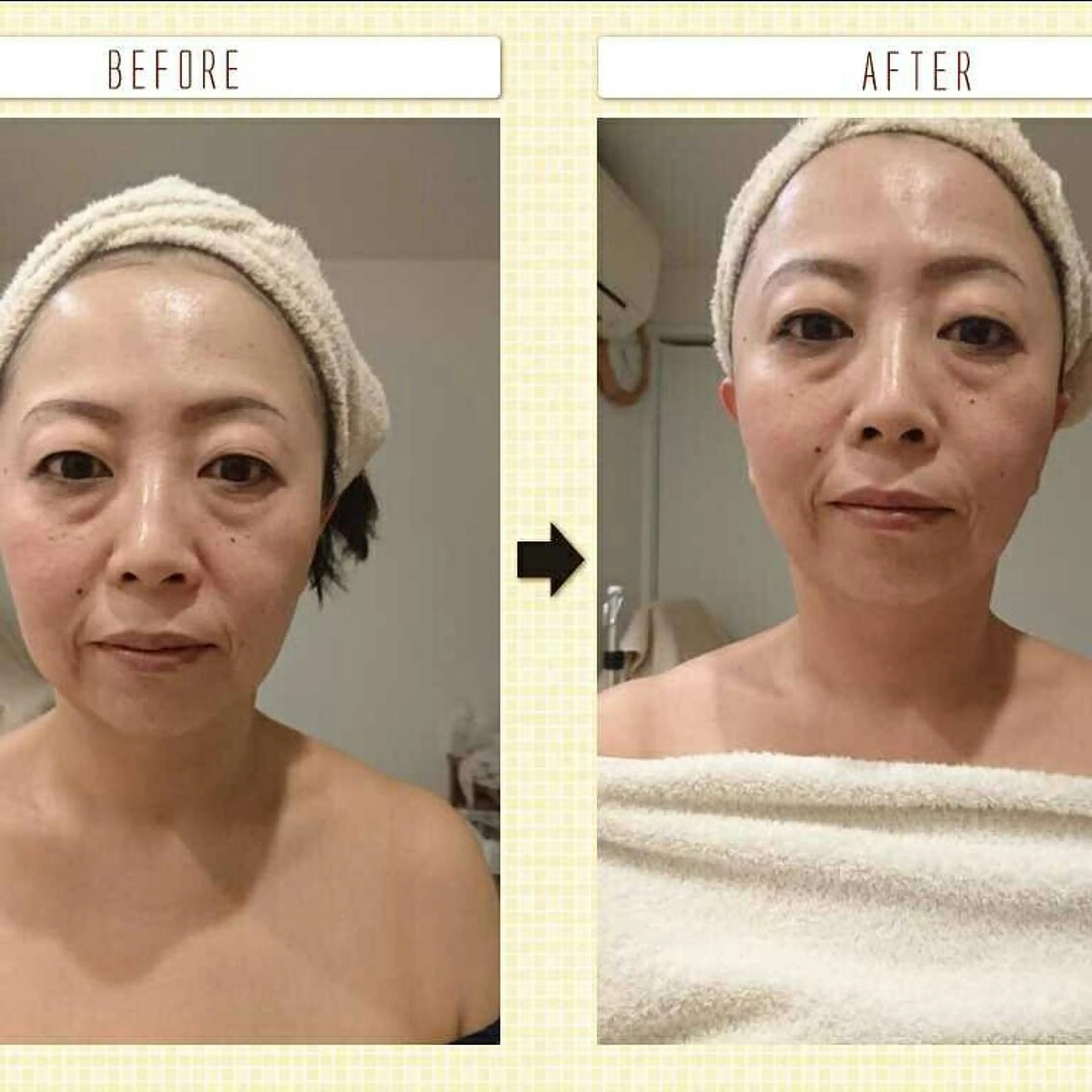 Arebeau 健康的にダイエットのエステ・リラクイメージ