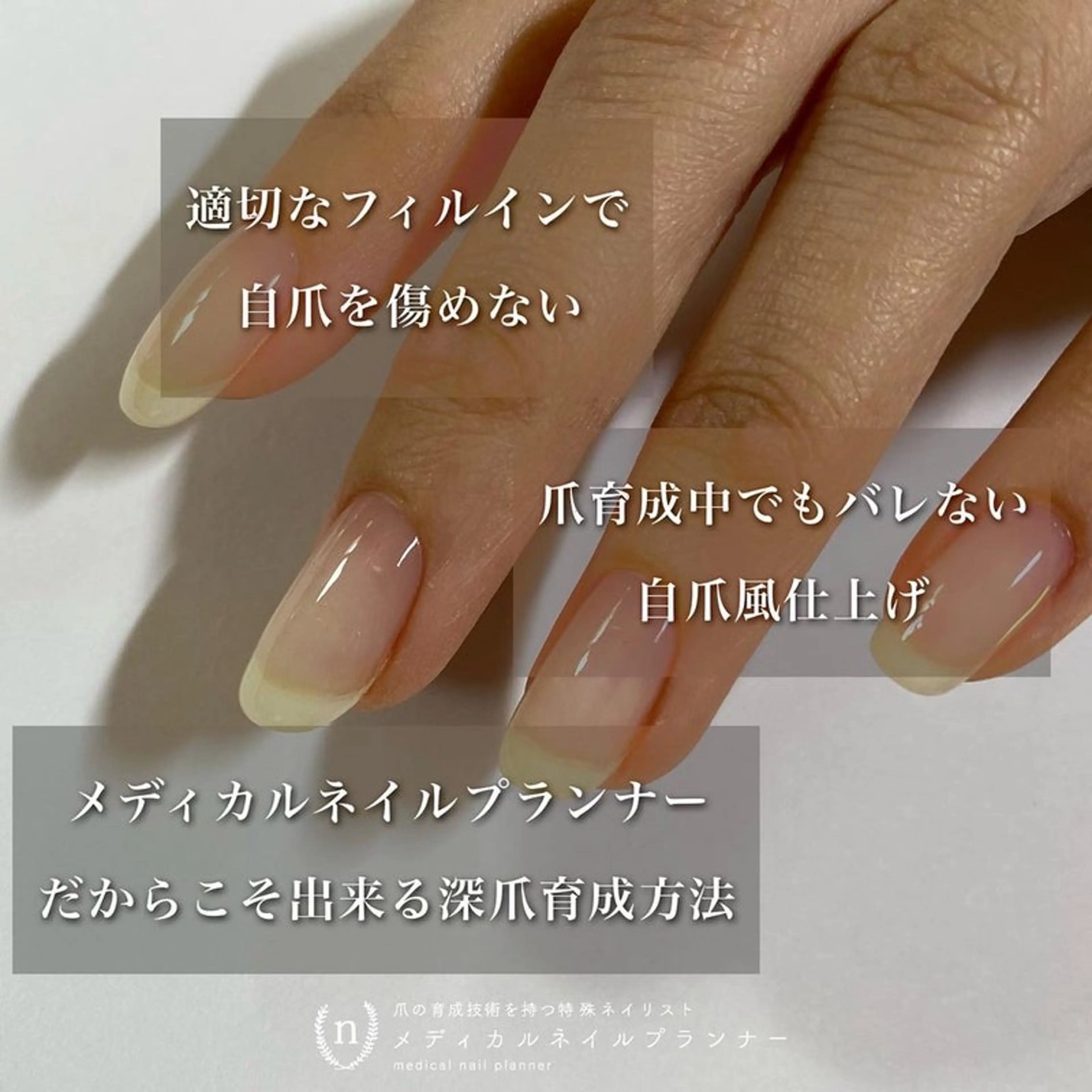 深爪育成(お持ち帰り頂けるネイルオイル込み)の写真