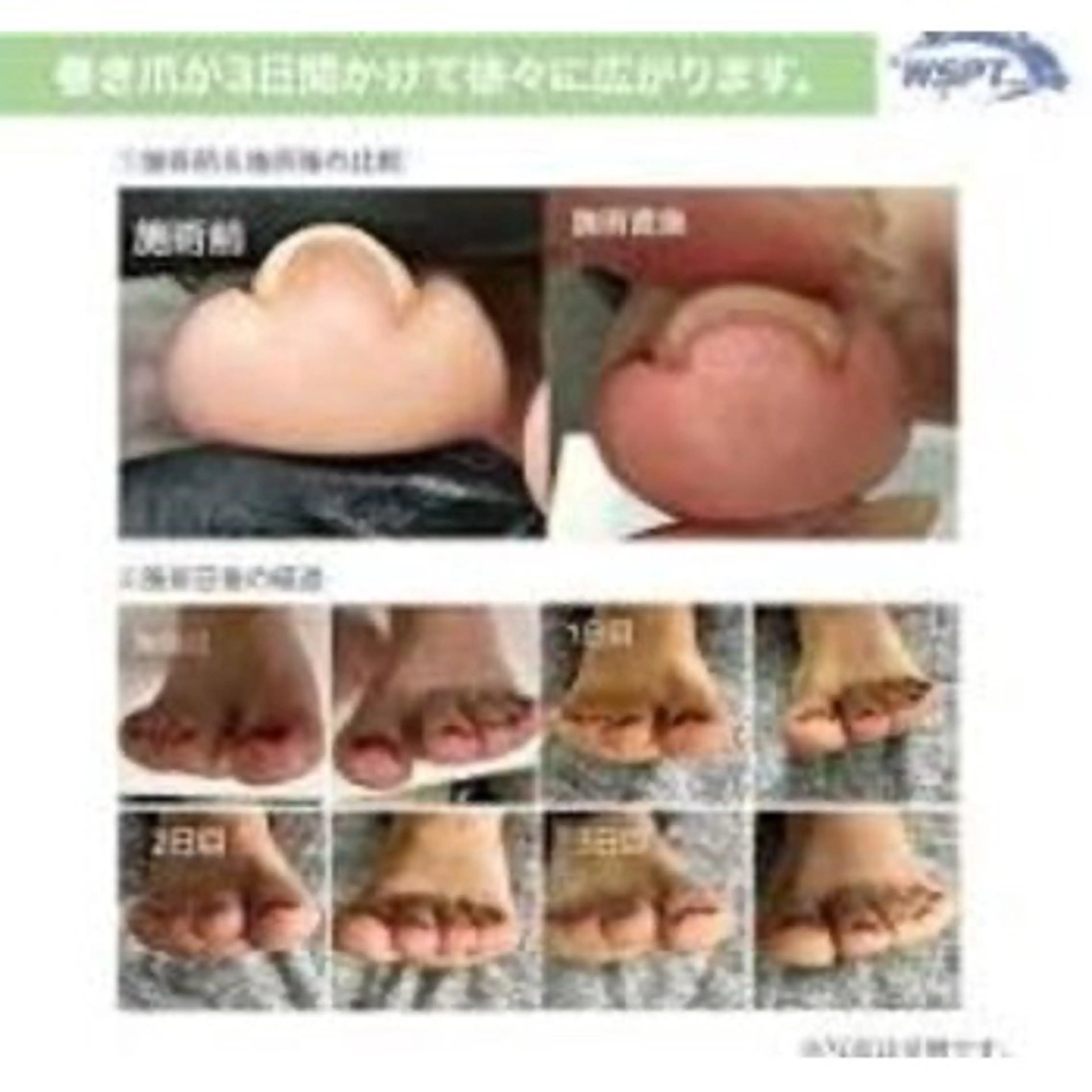 ネイル hiromi. ＊モデル募集＊のネイルデザイン