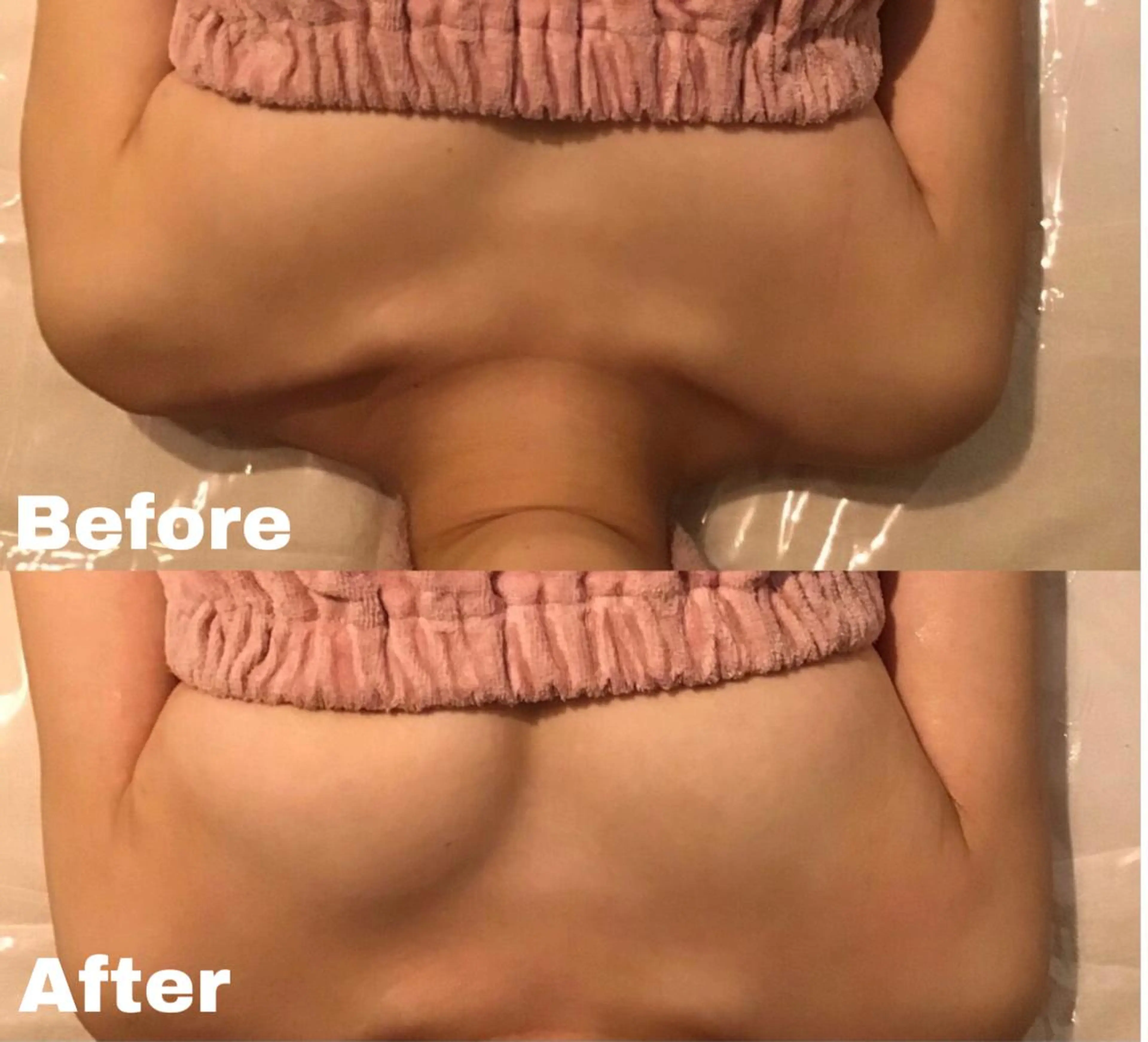 ✨ハイブリット最新の機器✨全身バストケア60分🍀大きさ、左右差、下垂などのお悩みに❣️の写真