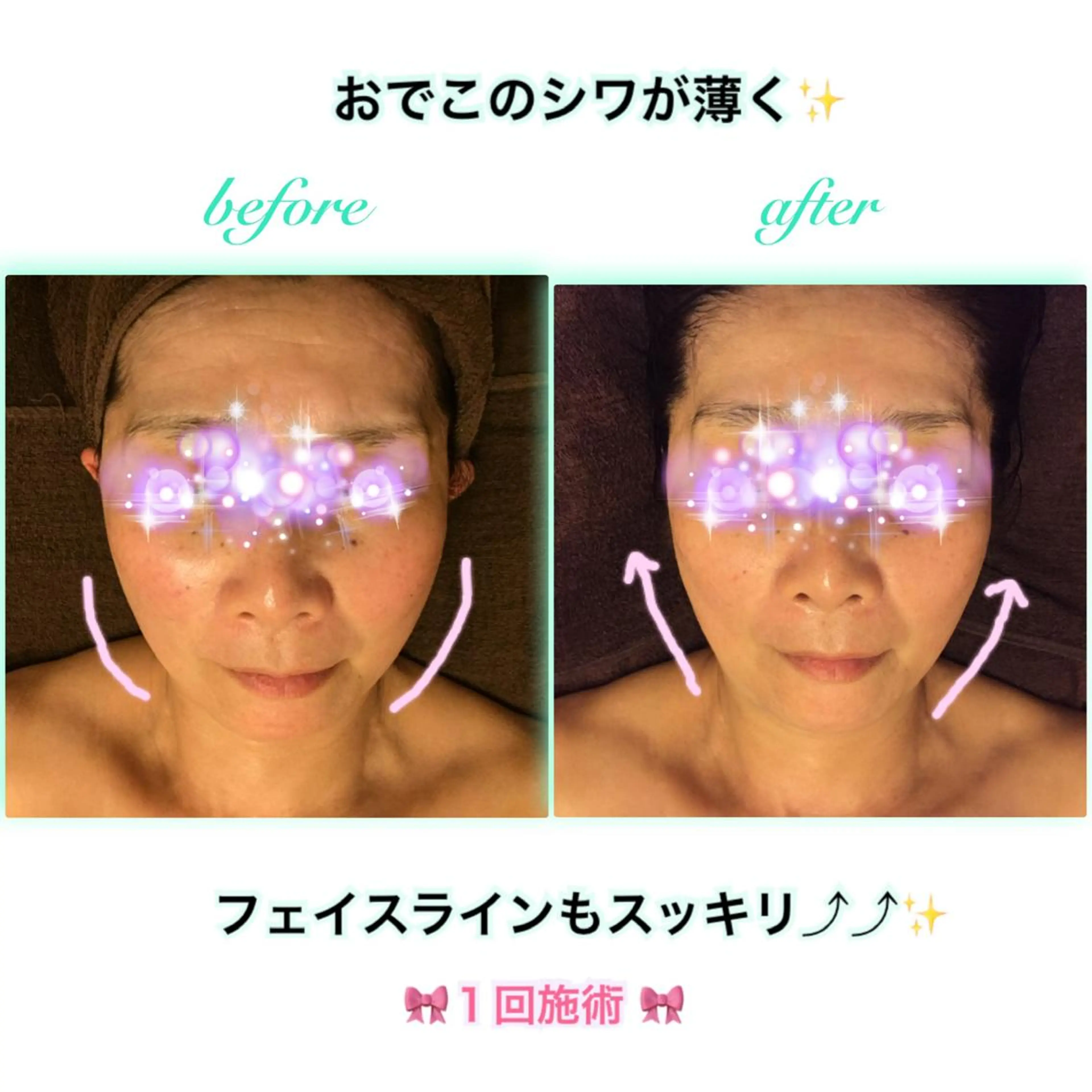 エステ リラク ダイエット・美肌ケア fleurのエステ・リラクイメージ