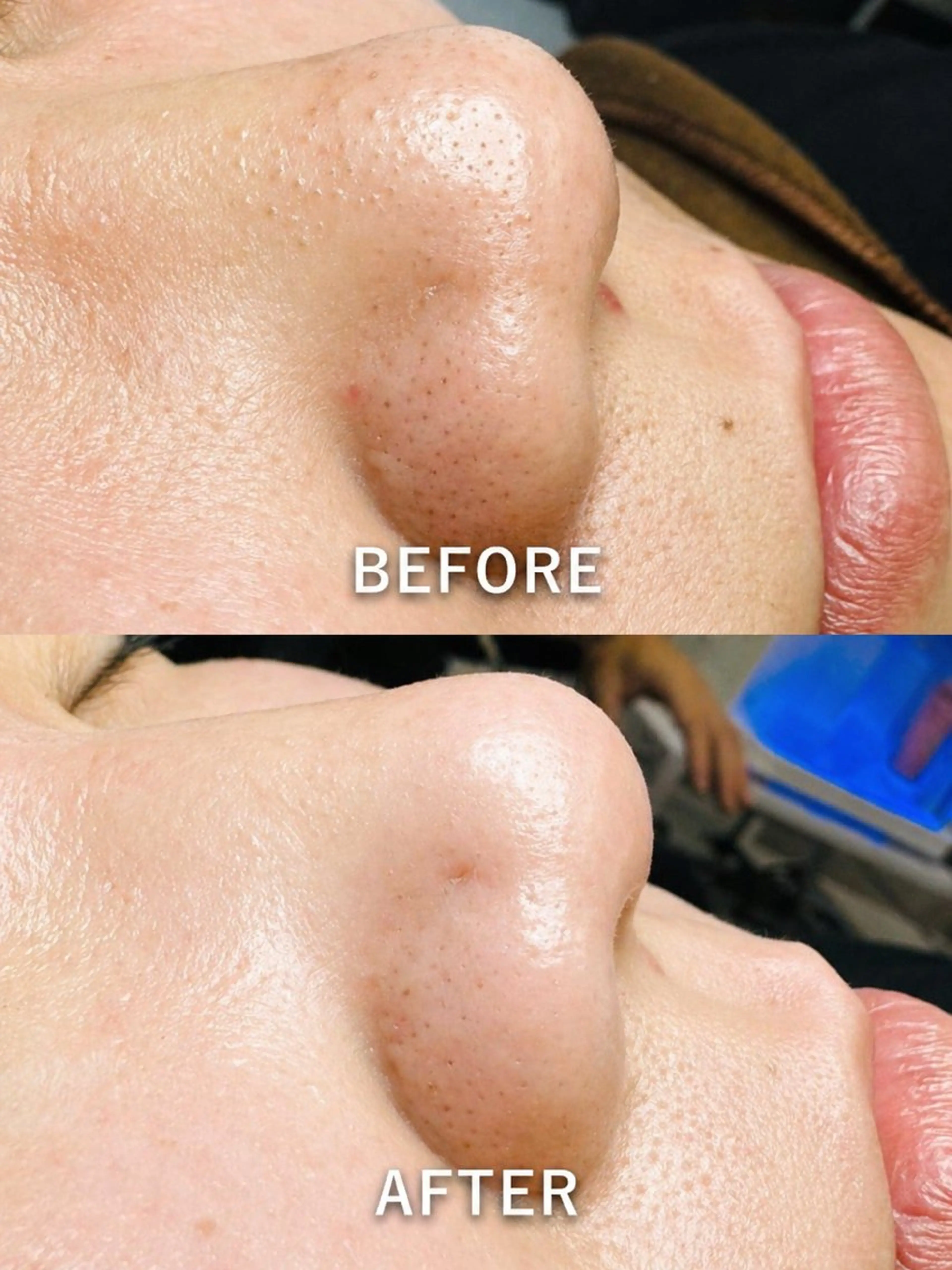 エステ LukeBeauty salonのエステ・リラクイメージ