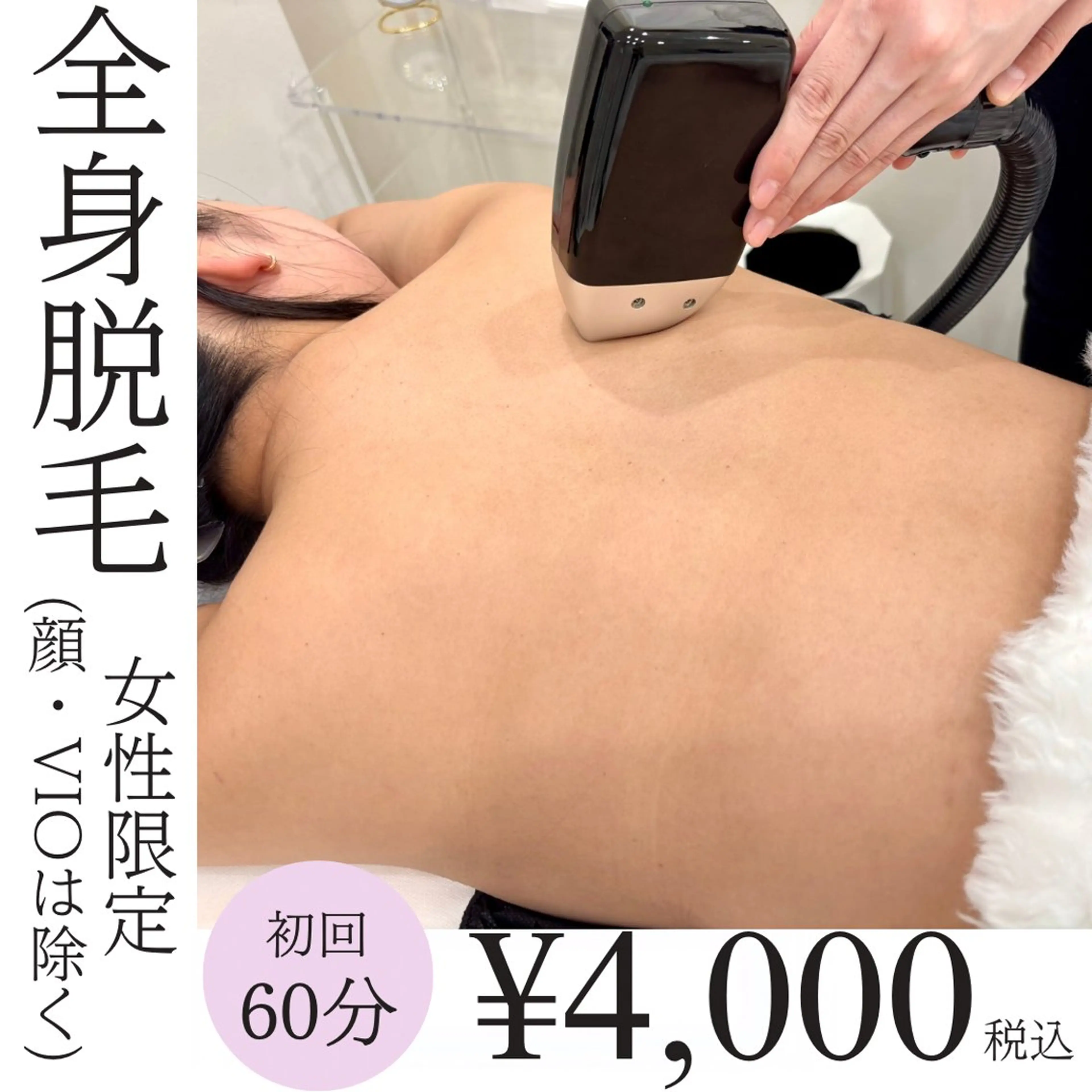 👸女性限定👸全身脱毛¥4,000の写真