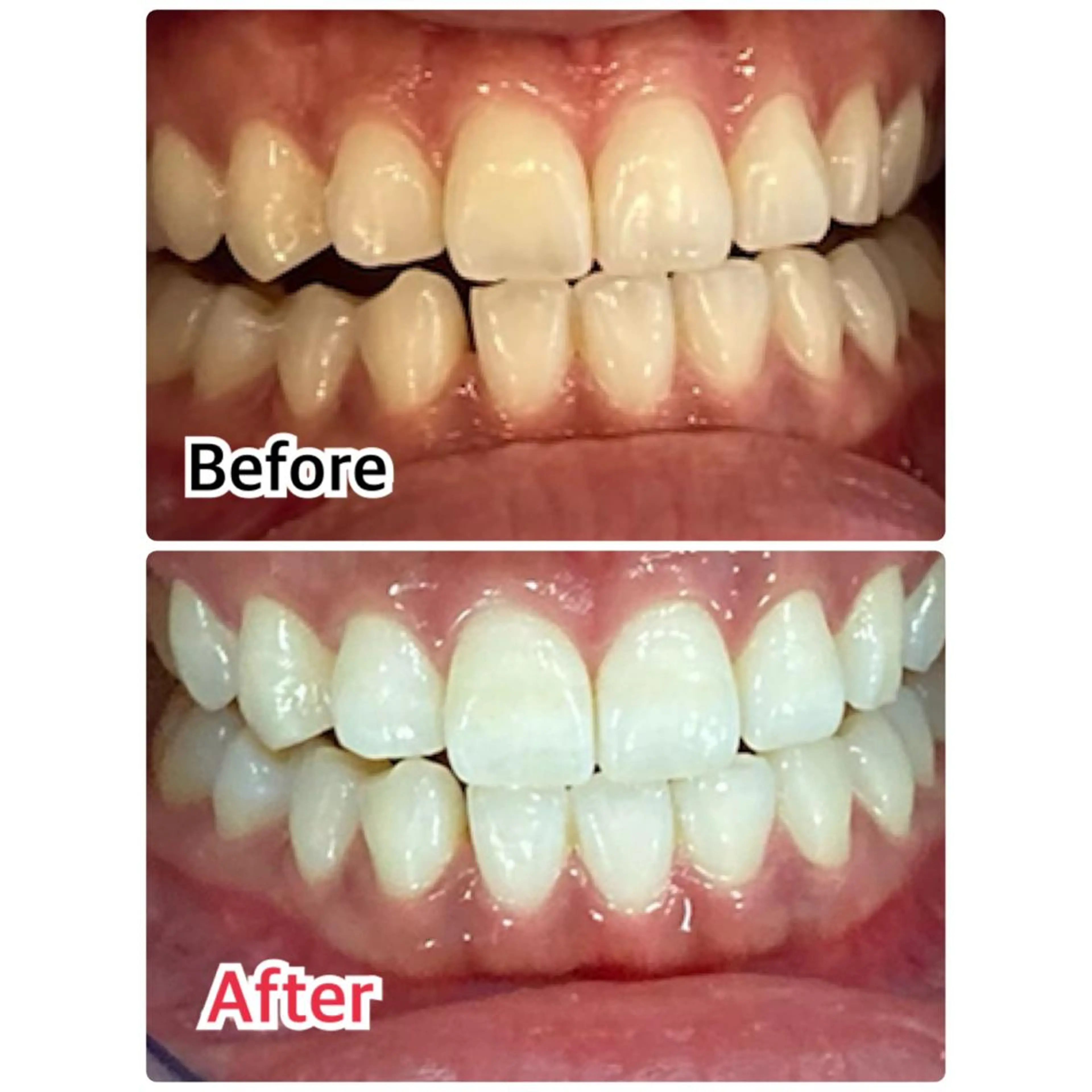 【歯科提携】柏ホワイ トニングスタイルのその他イメージ