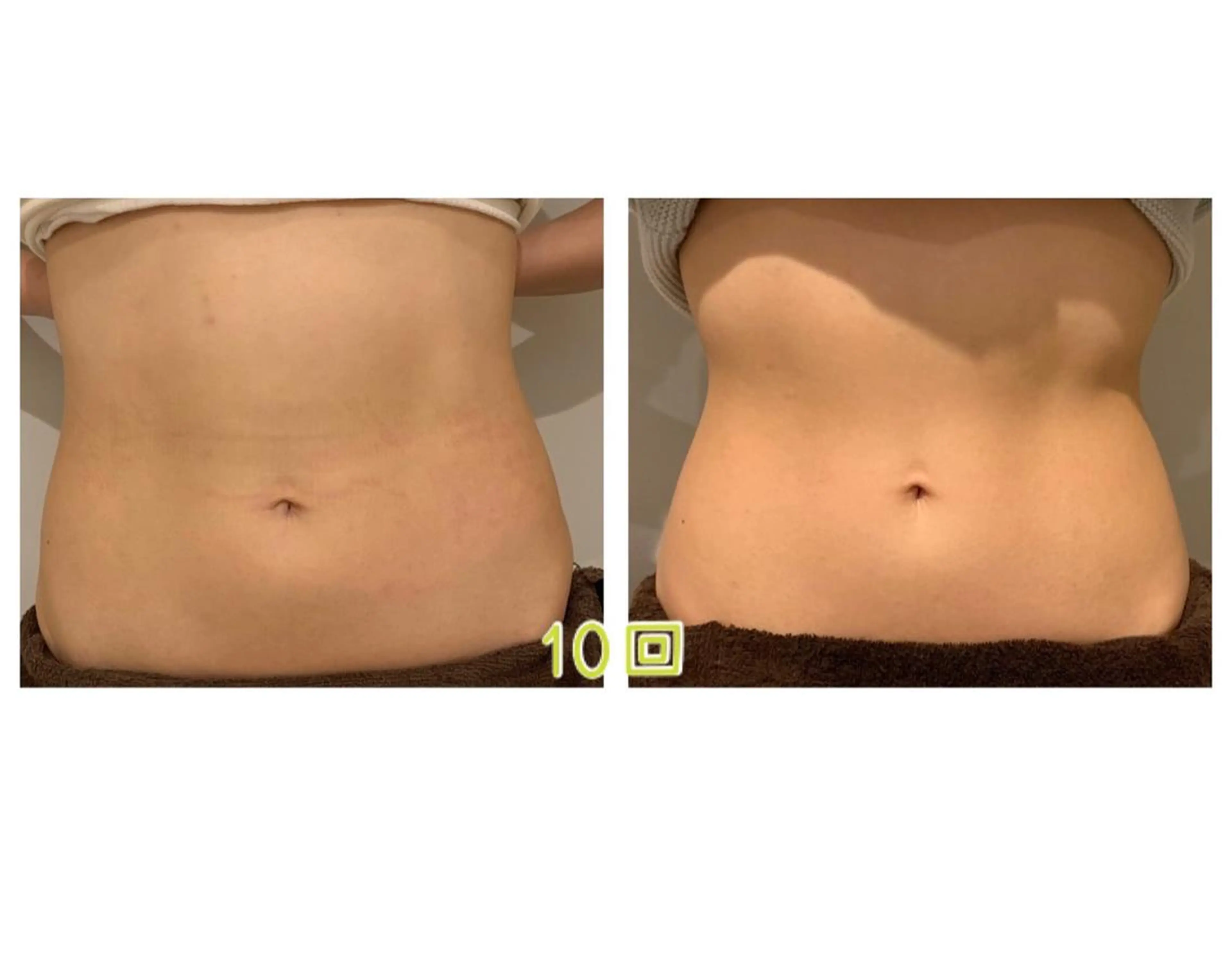 エステ リラク 癒し腸もみサロン シャユーム　ゆきなのエステ・リラクイメージ