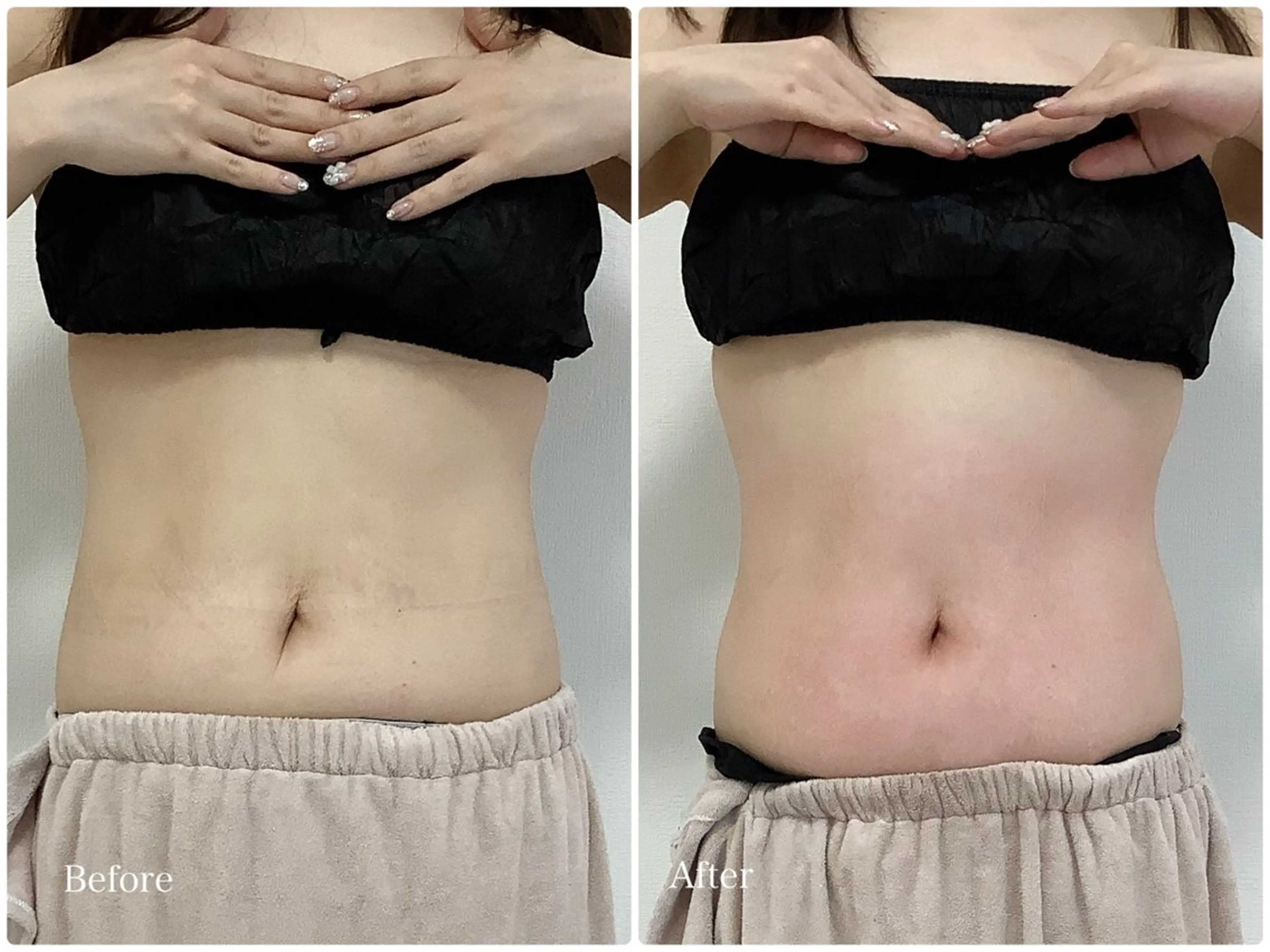 LiAm《美肌管理/ 小顔/脂肪ケア》のその他イメージ