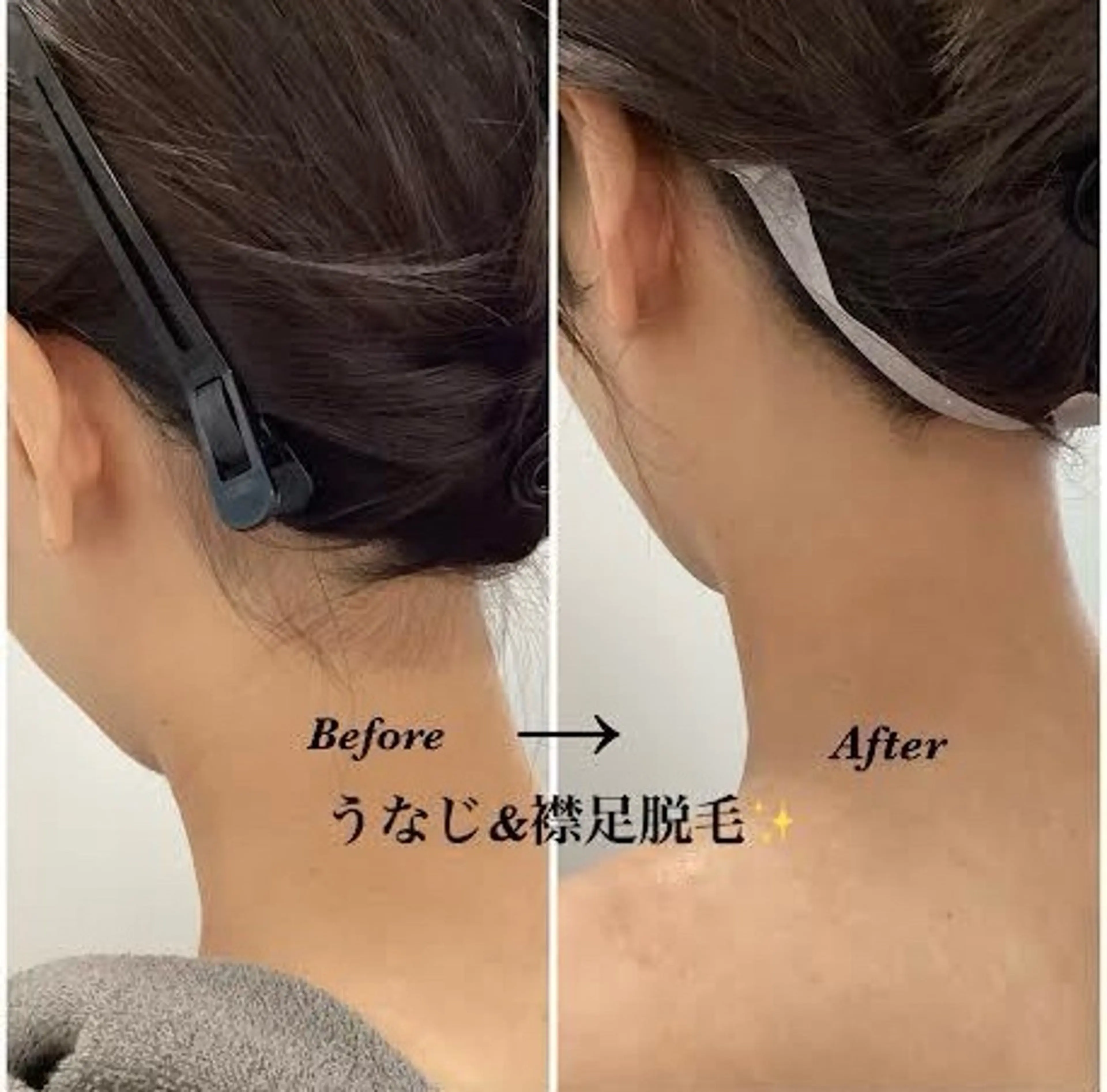 脱毛 韓国肌管理×毛穴 改善専門🤍nanaのエステ・リラクイメージ