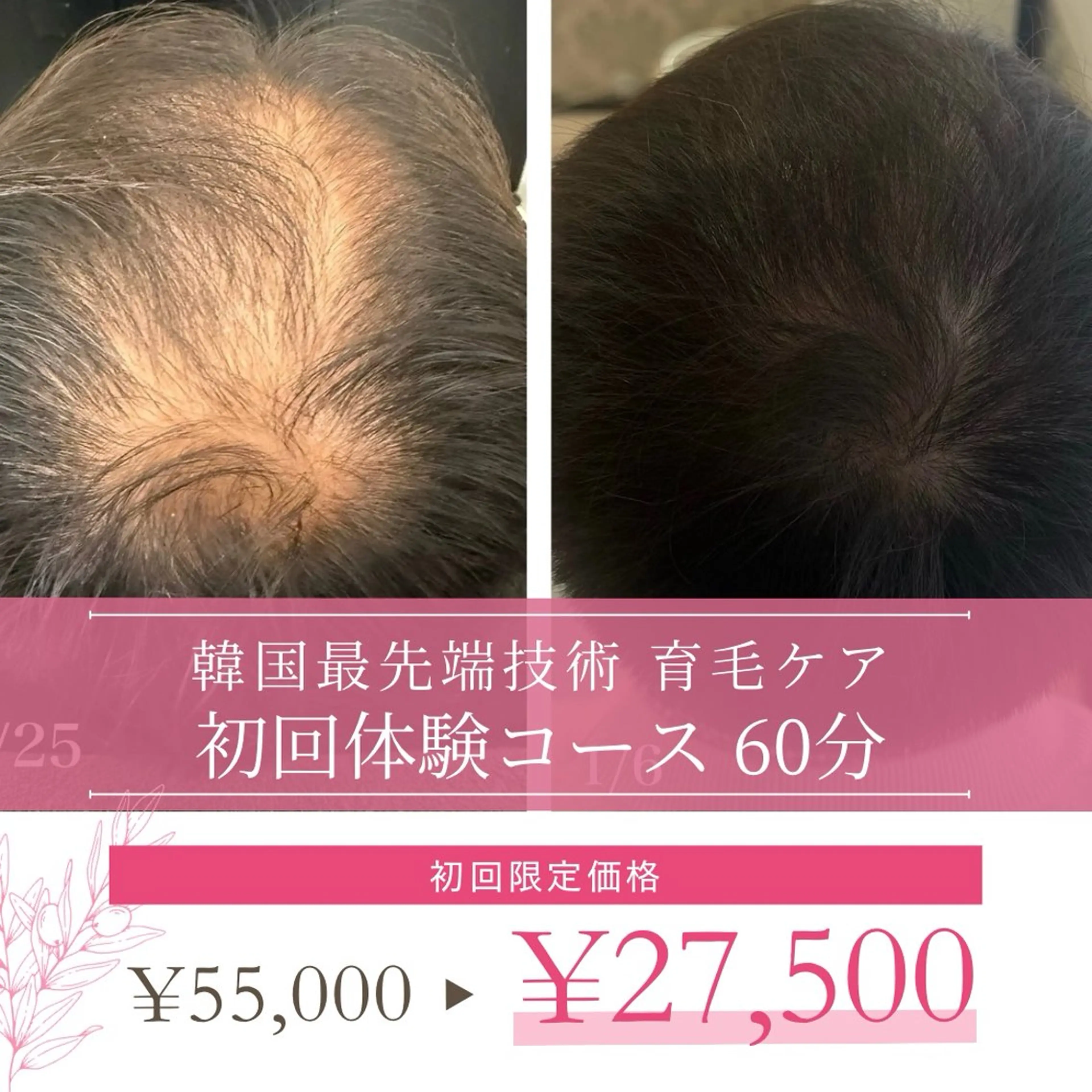 ショート カラー パーマ ヘアアレンジ メンズ キッズ 美肌脱毛エステサロン Luangeのエステ・リラクイメージ